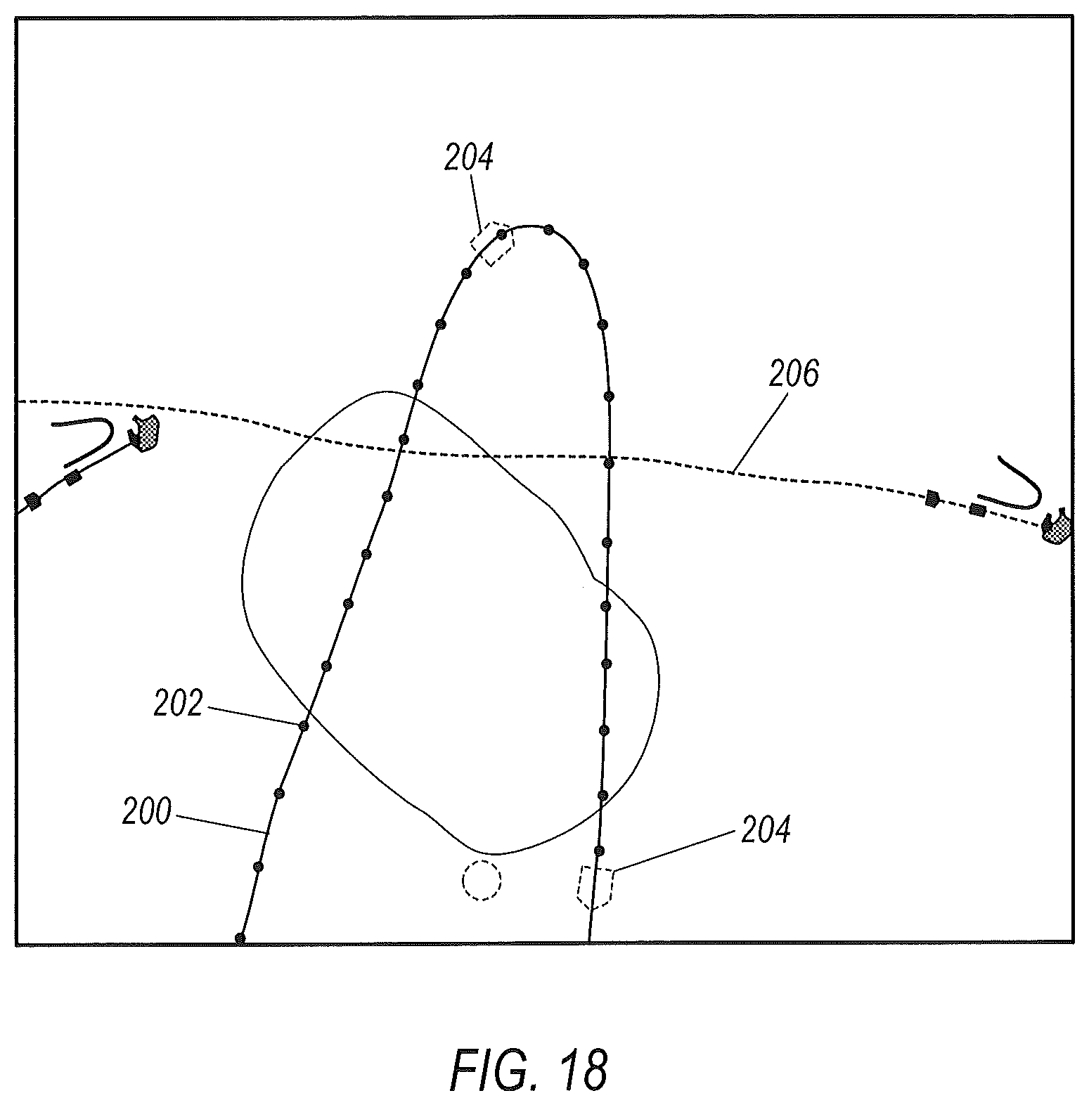 Patent US12137990 Figure 17 – Systems and methods for localizing, tracking and/or controlling medical instruments