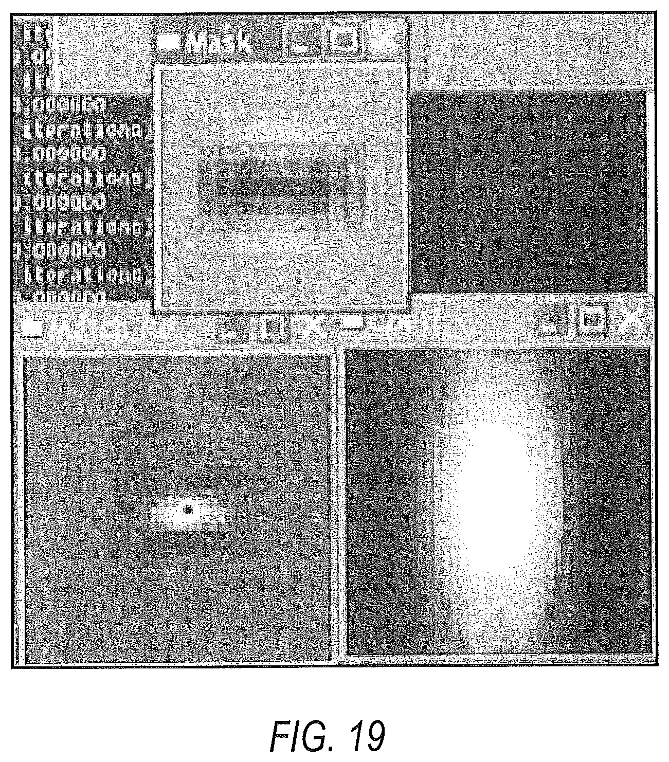 Patent US12137990 Figure 18 – Systems and methods for localizing, tracking and/or controlling medical instruments