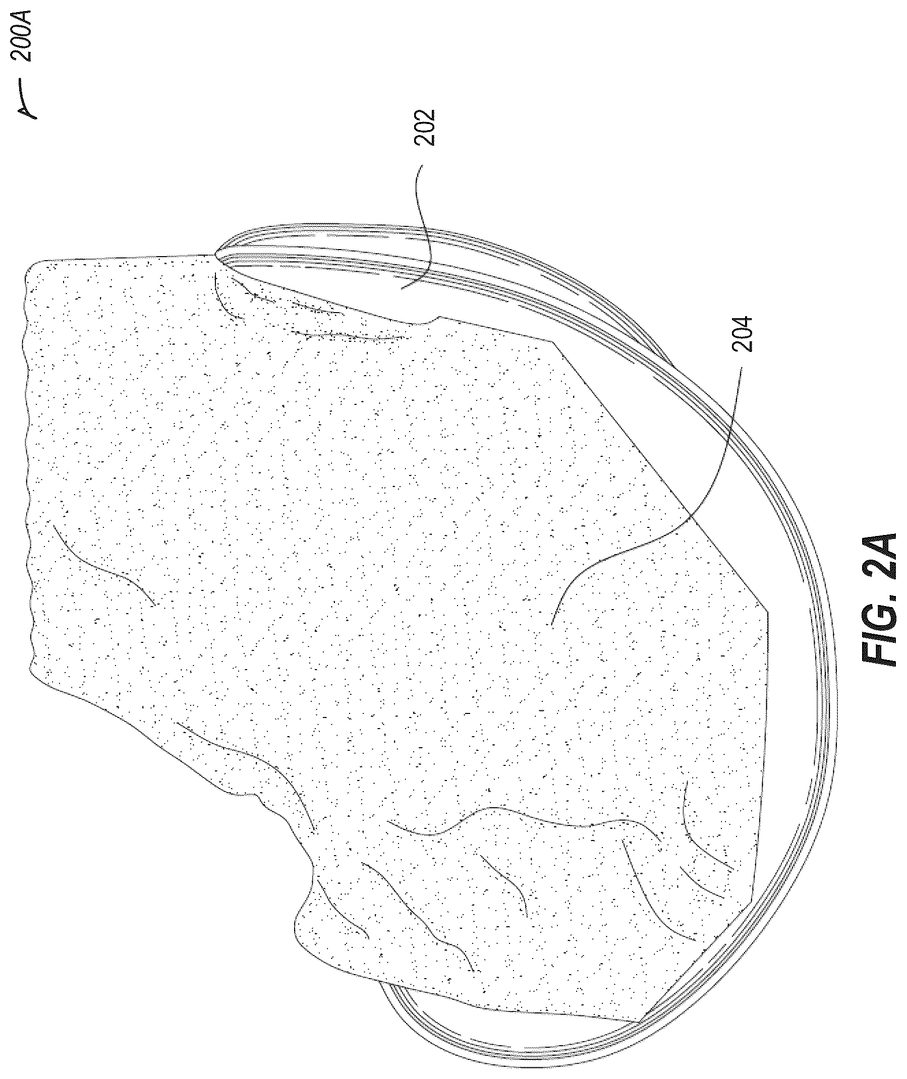 Patent US12137996 Figure 2 – Revision robotics