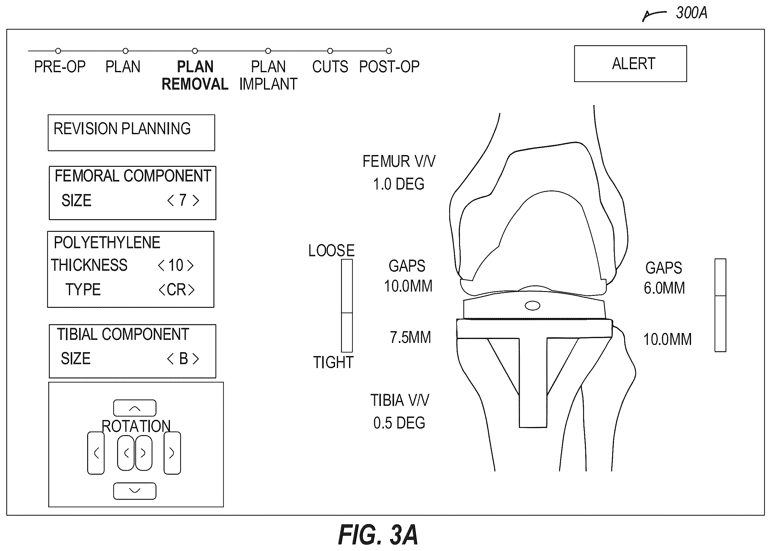 Patent US12137996 Figure 5 – Revision robotics