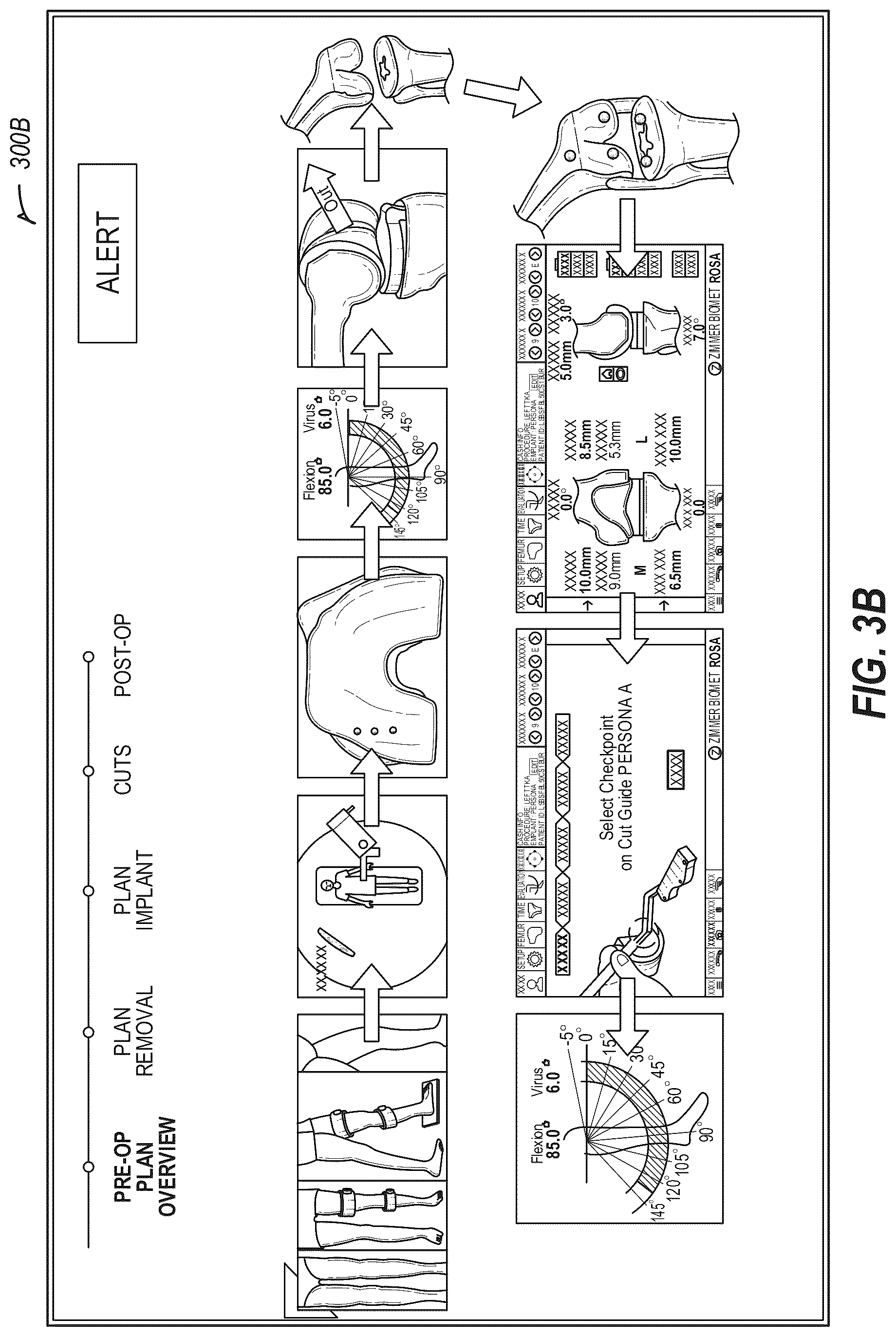 Patent US12137996 Figure 6 – Revision robotics
