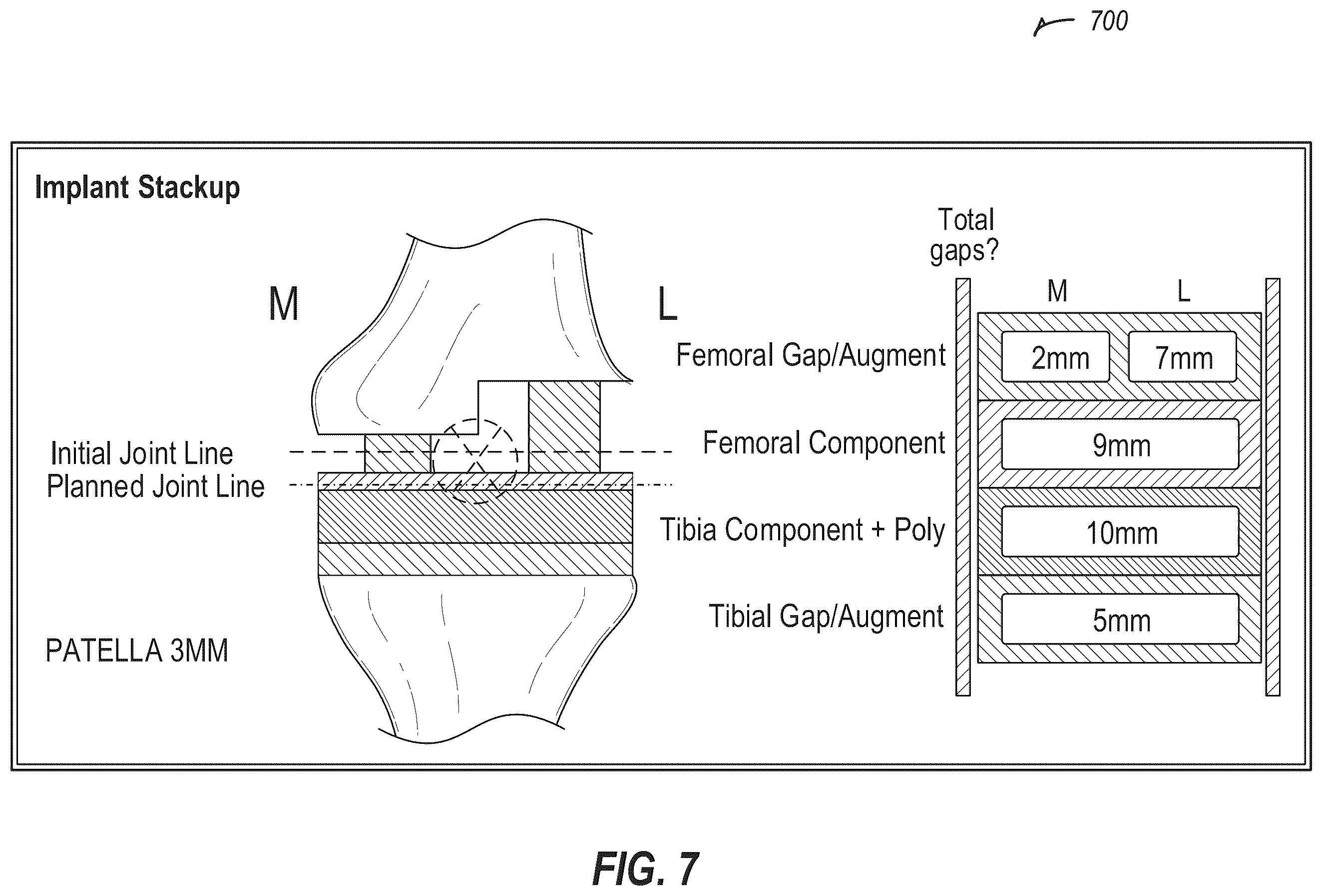 Patent US12137996 Figure 10 – Revision robotics