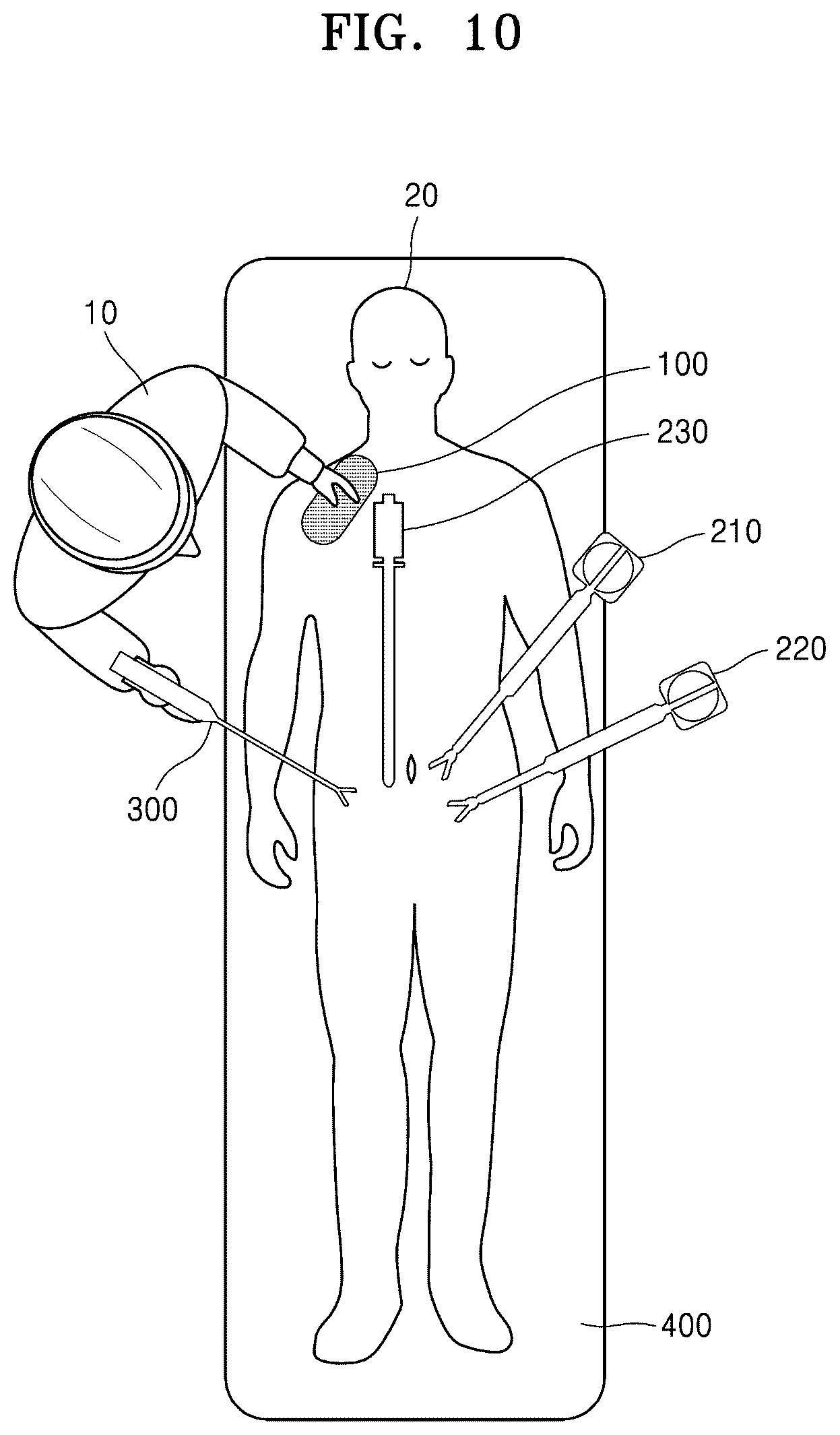 Patent US12137999 Figure 10 – Methods for laparoscopic surgery with assist robot and controlling methods for laparoscopic surgery system with assist robot
