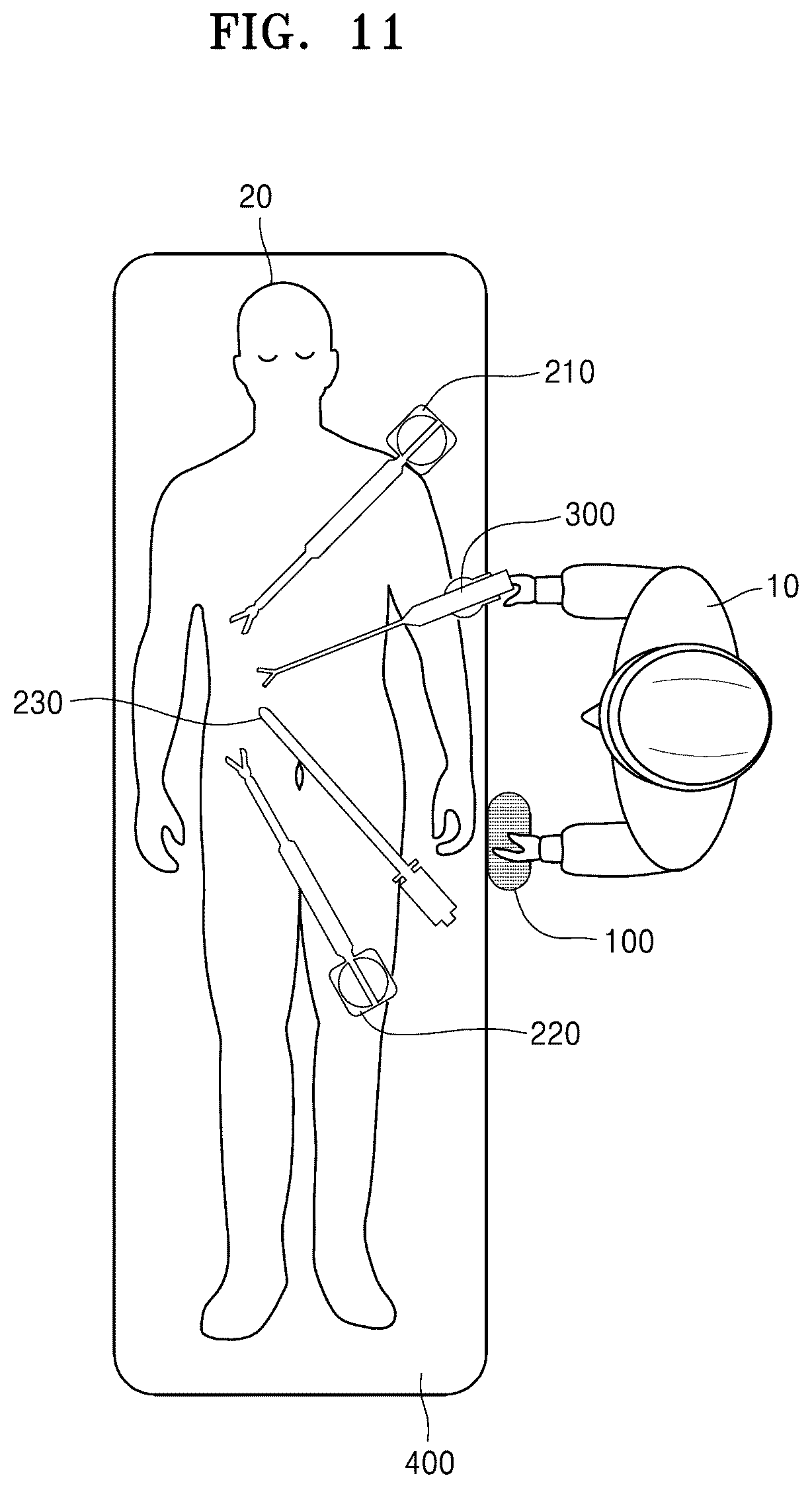 Patent US12137999 Figure 11 – Methods for laparoscopic surgery with assist robot and controlling methods for laparoscopic surgery system with assist robot
