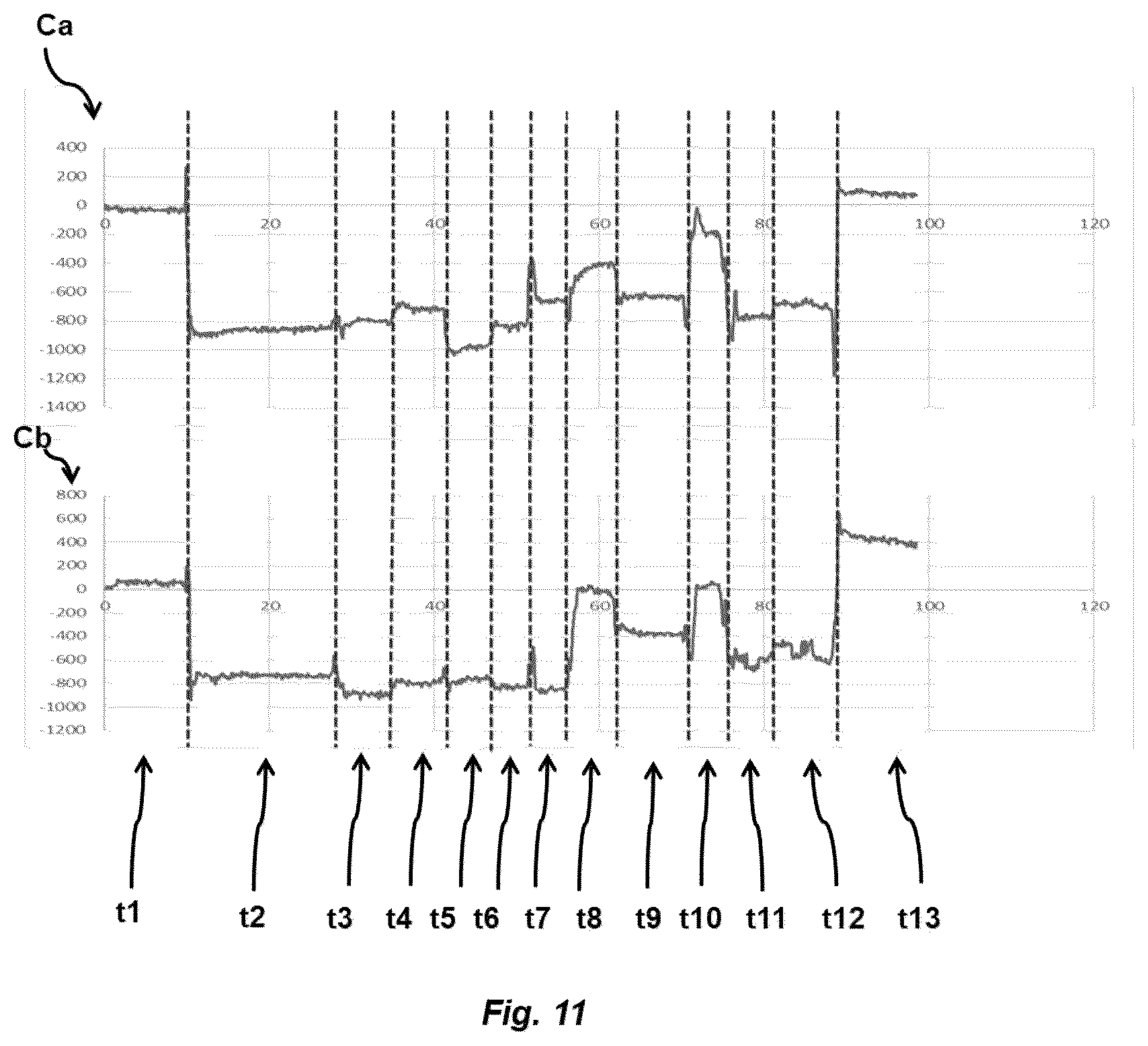 Patent US12139046 Figure 10 – Vehicle seat with monitoring system