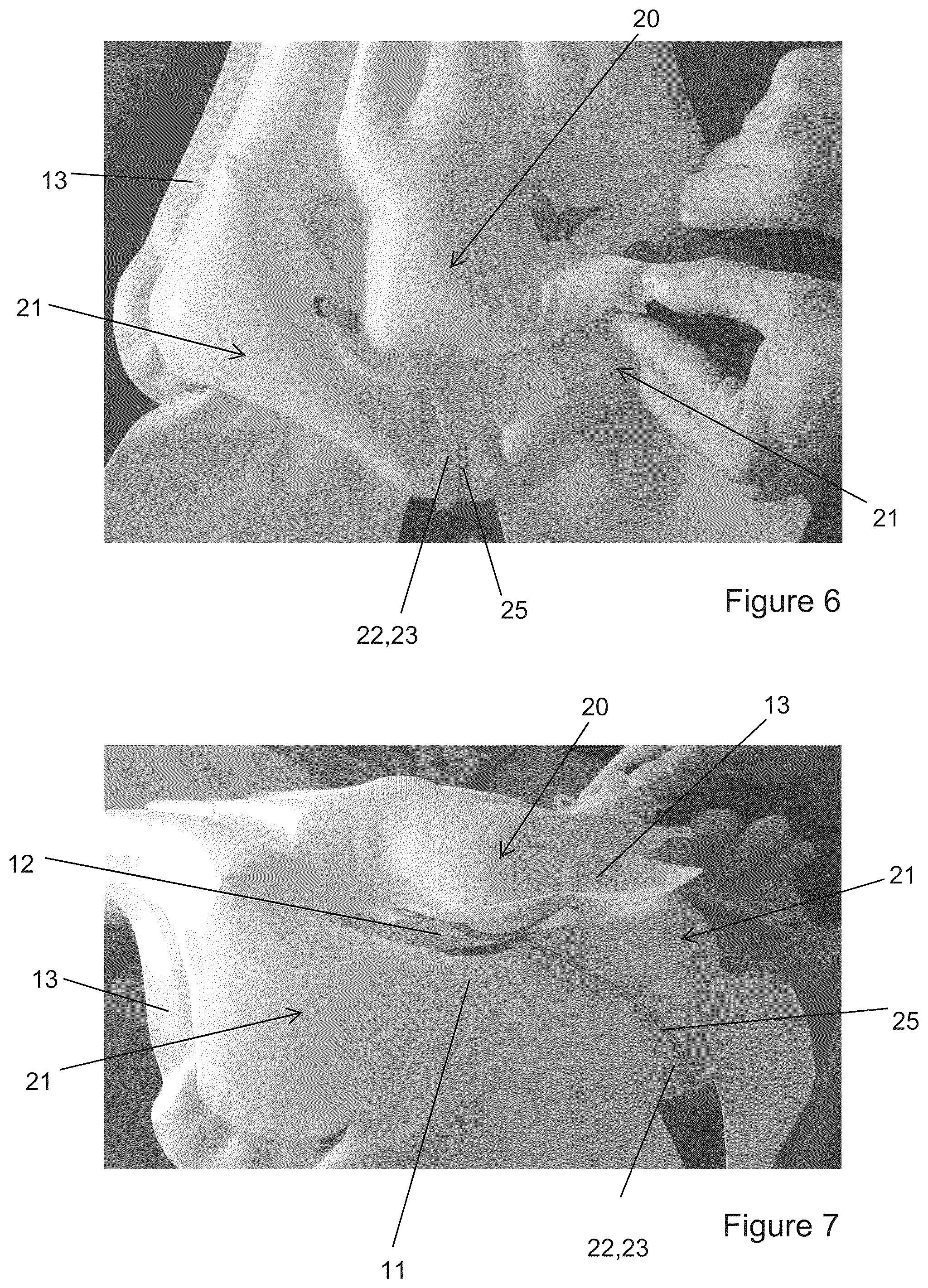 Patent US12139093 Figure 4 – Inflatable airbag