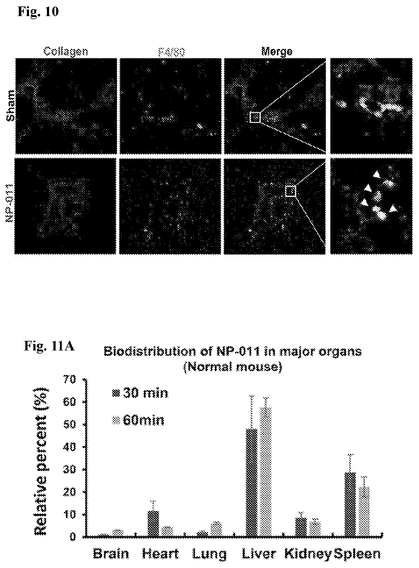 Patent US12139518 Figure 17 – Compositions and methods for treating or preventing fibrosis