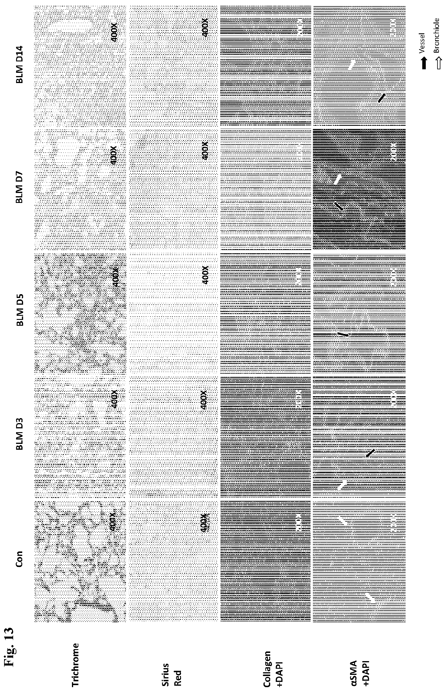 Patent US12139518 Figure 20 – Compositions and methods for treating or preventing fibrosis