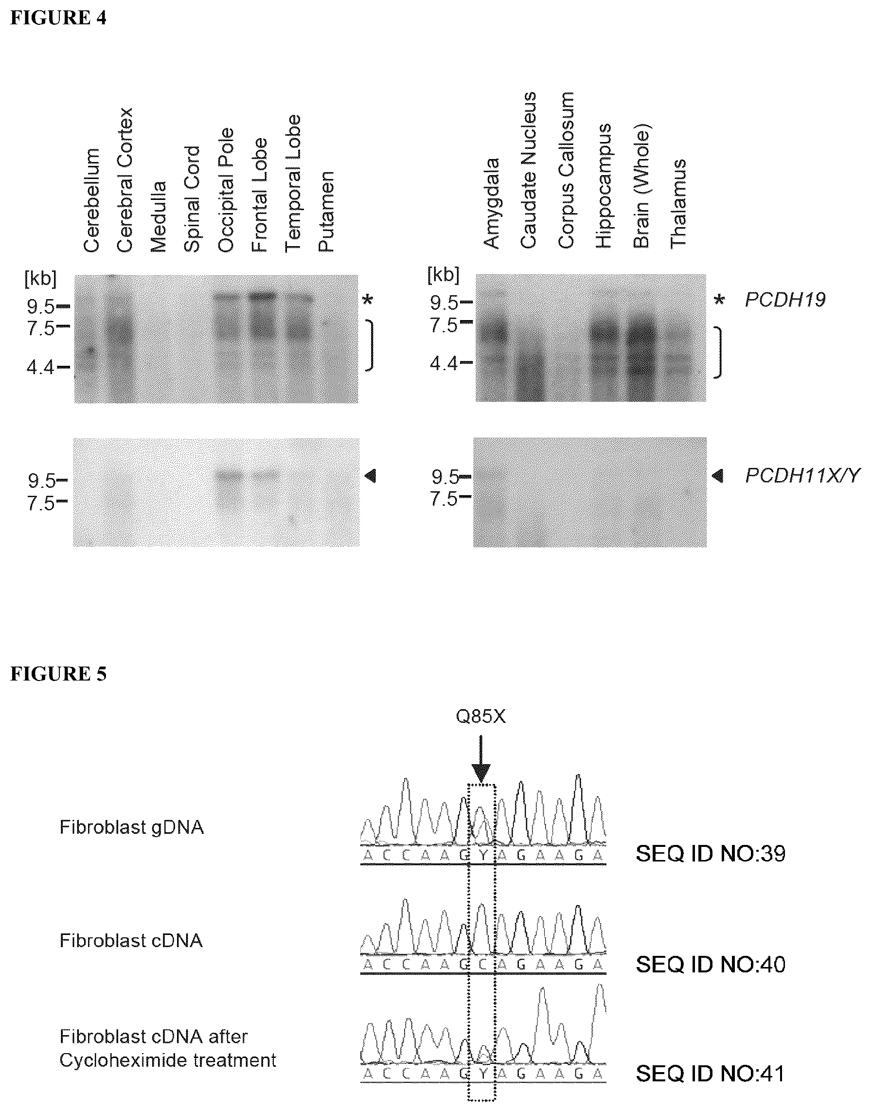 Patent US12139521 Figure 3 – Diagnostic and therapeutic methods for EFMR (epilepsy and mental retardation limited to females)