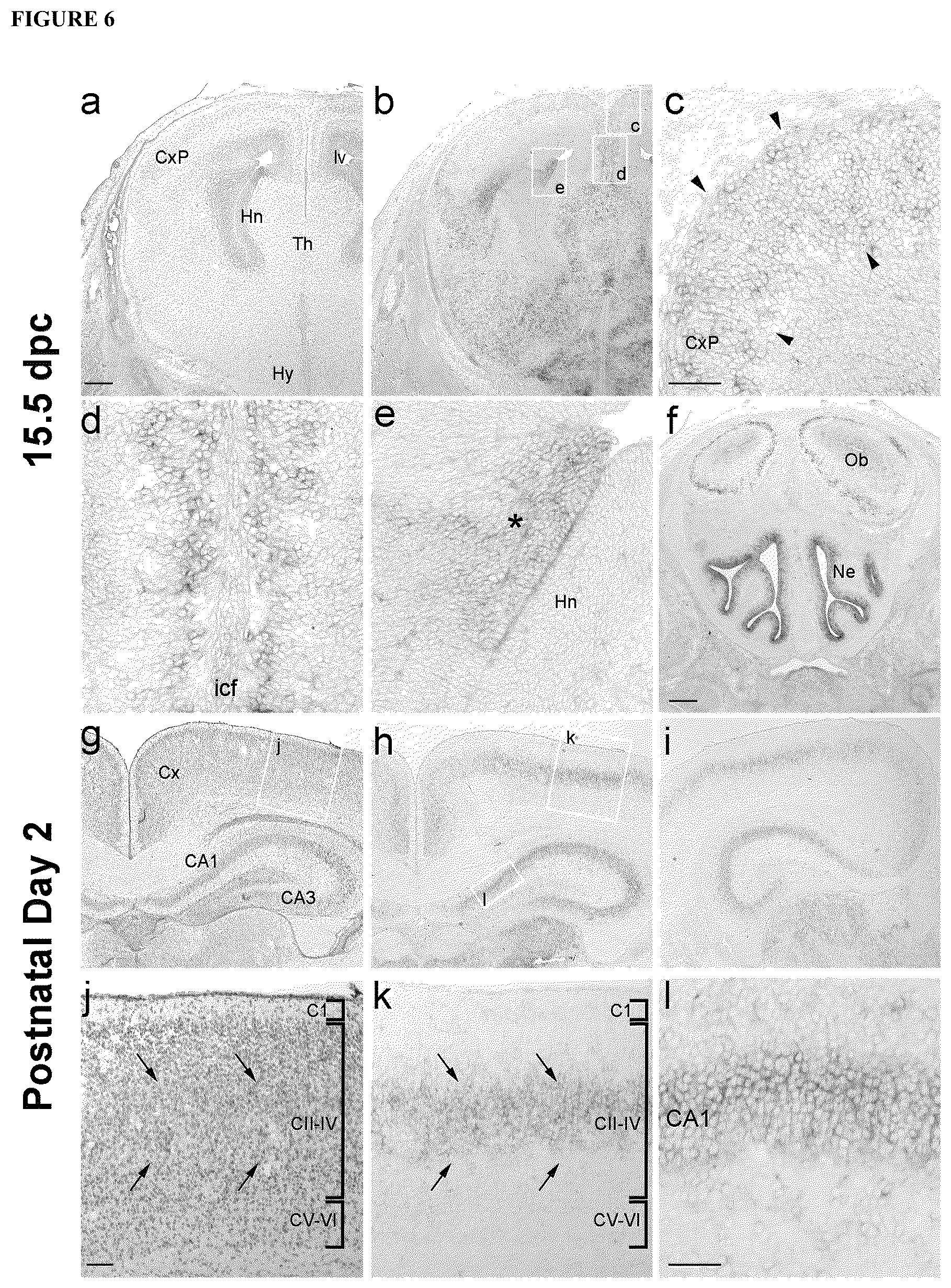 Patent US12139521 Figure 4 – Diagnostic and therapeutic methods for EFMR (epilepsy and mental retardation limited to females)