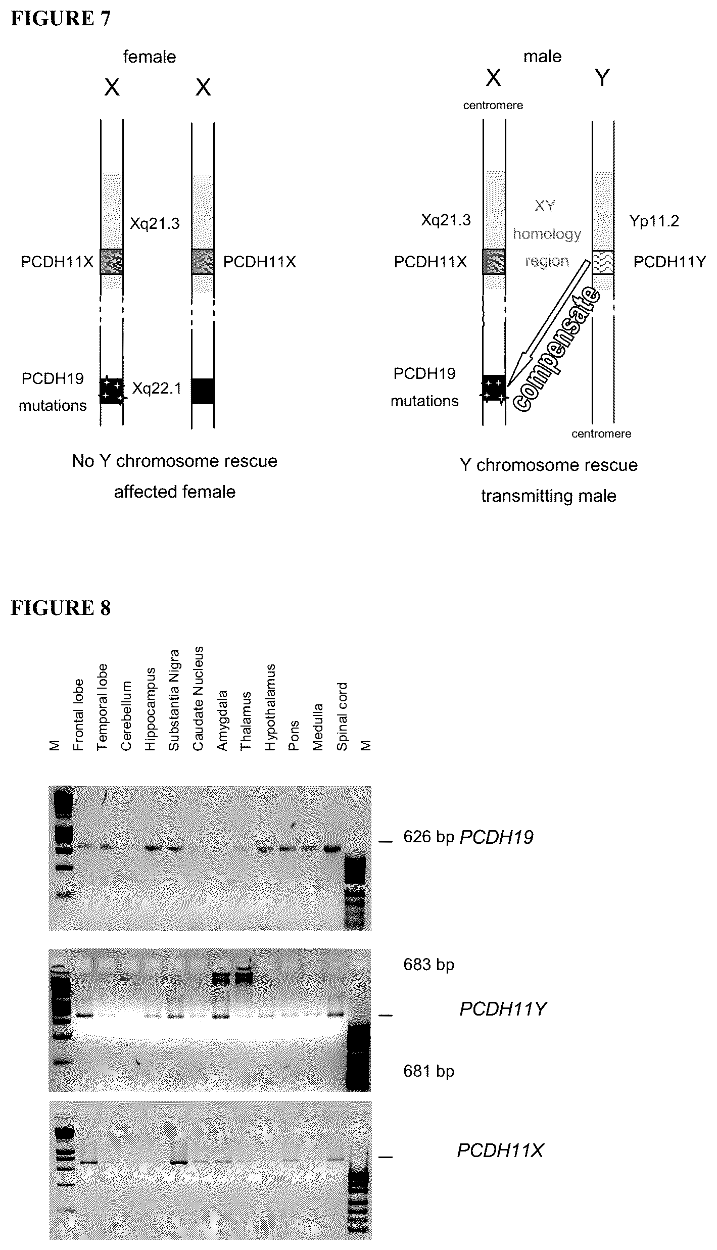 Patent US12139521 Figure 5 – Diagnostic and therapeutic methods for EFMR (epilepsy and mental retardation limited to females)
