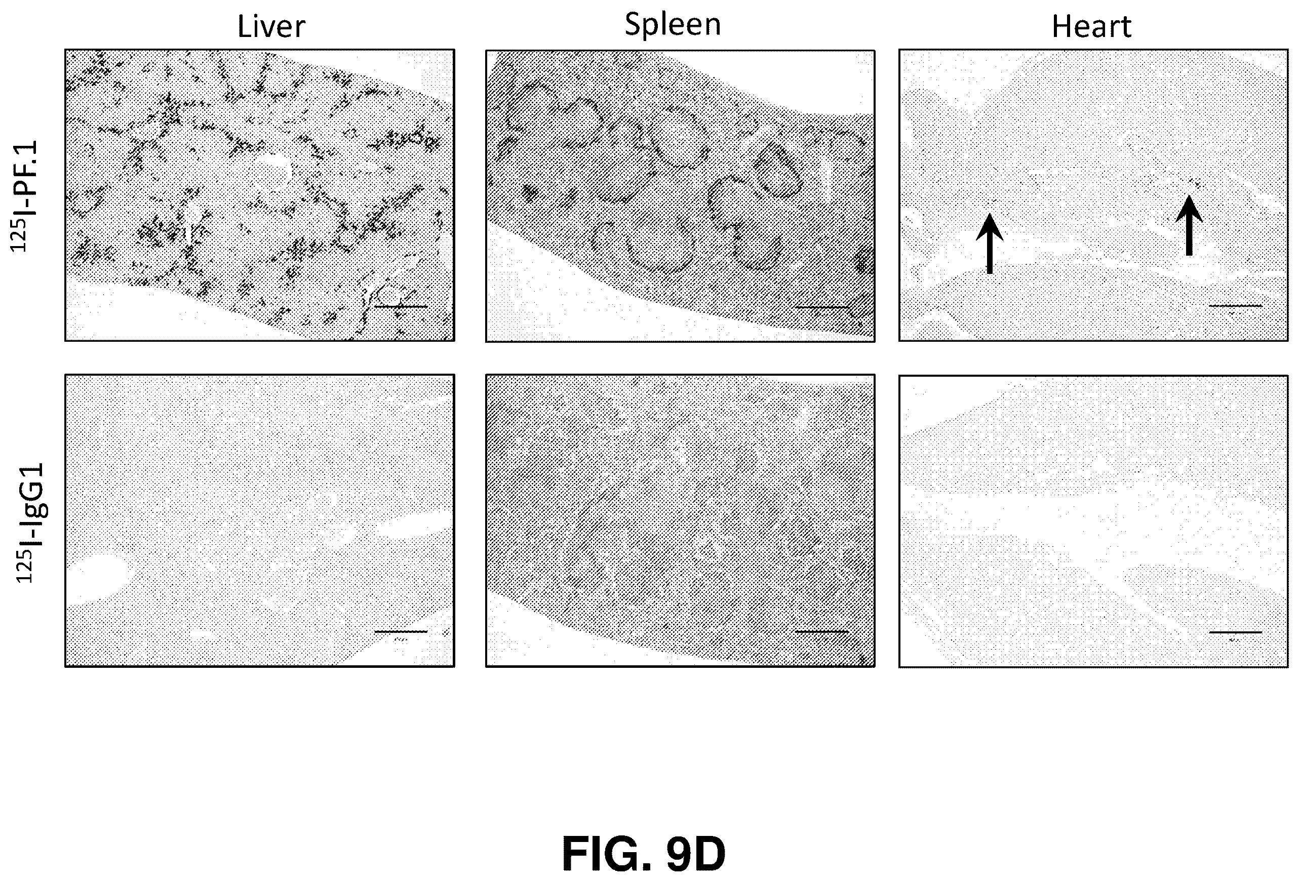 Patent US12139529 Figure 17 – Antibody-peptide fusion proteins for treating amyloid disorders