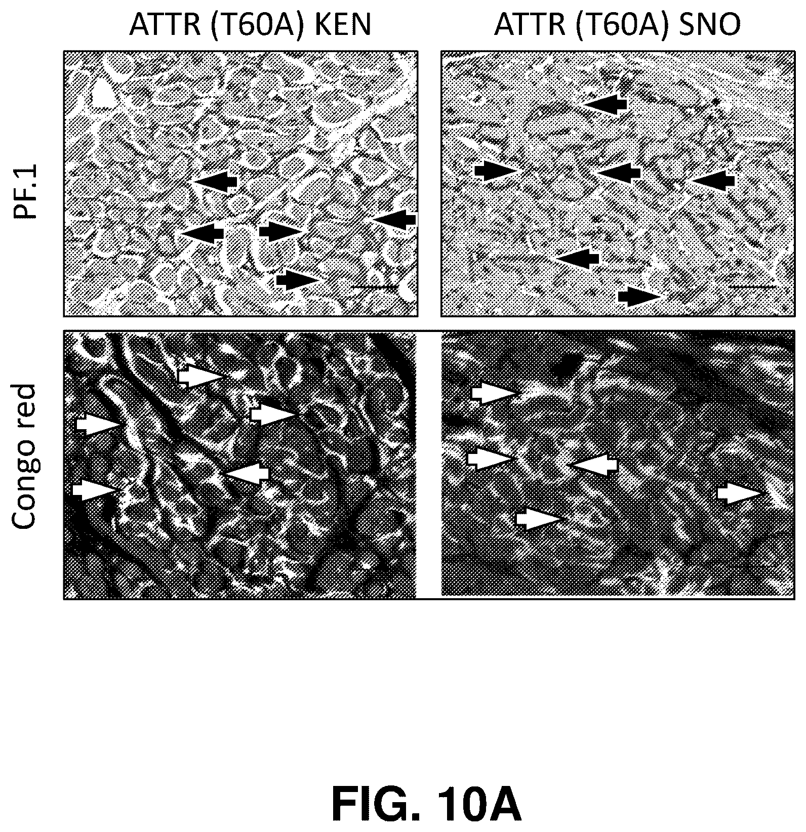 Patent US12139529 Figure 18 – Antibody-peptide fusion proteins for treating amyloid disorders