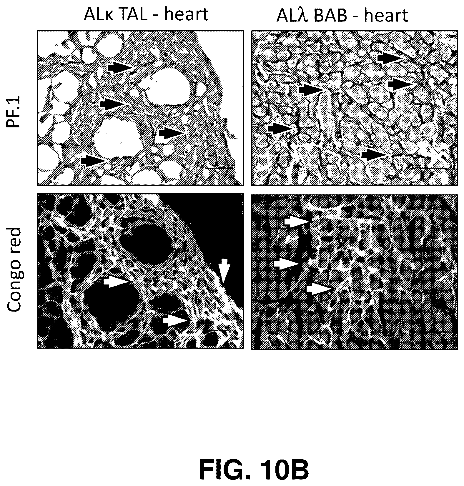 Patent US12139529 Figure 19 – Antibody-peptide fusion proteins for treating amyloid disorders