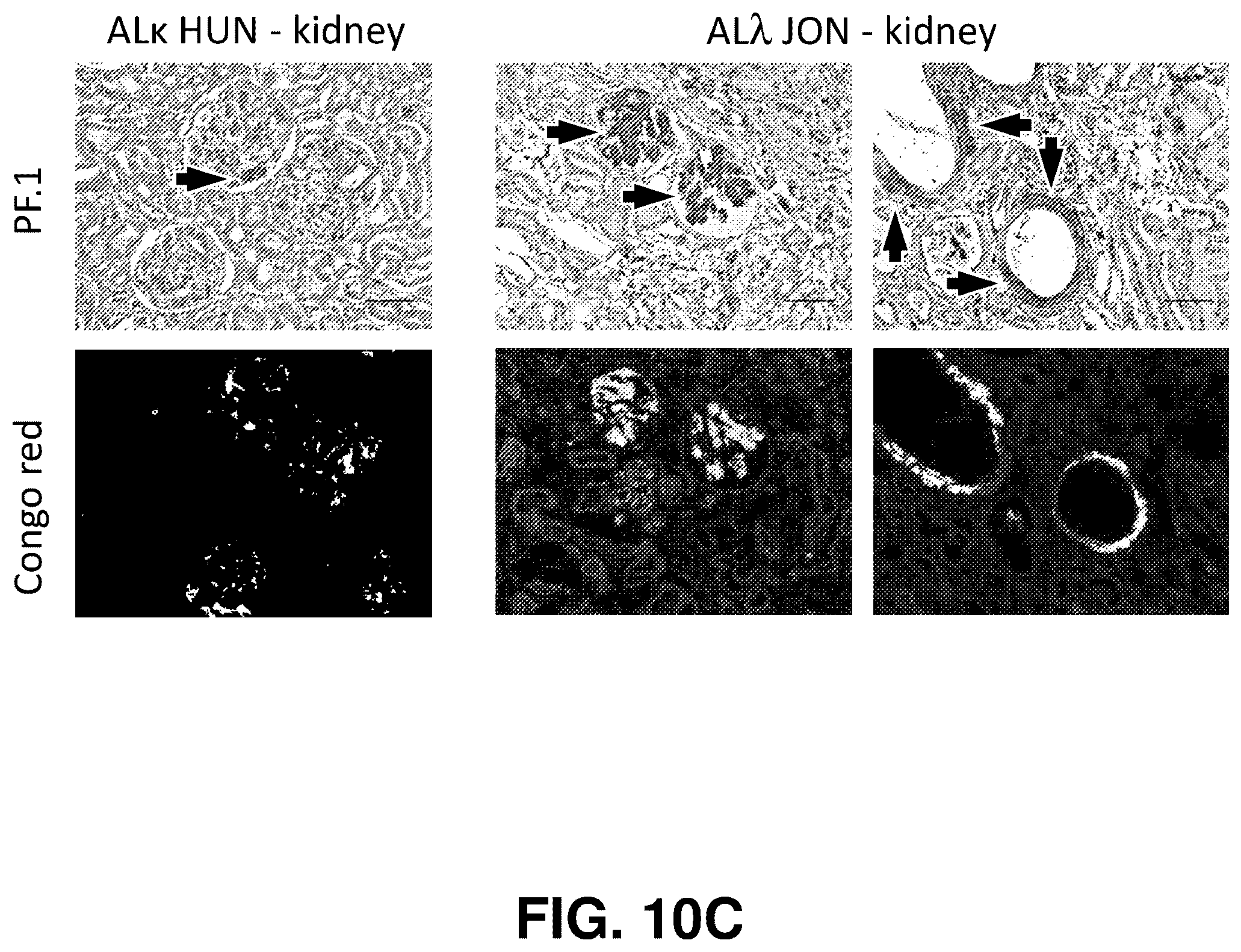 Patent US12139529 Figure 20 – Antibody-peptide fusion proteins for treating amyloid disorders