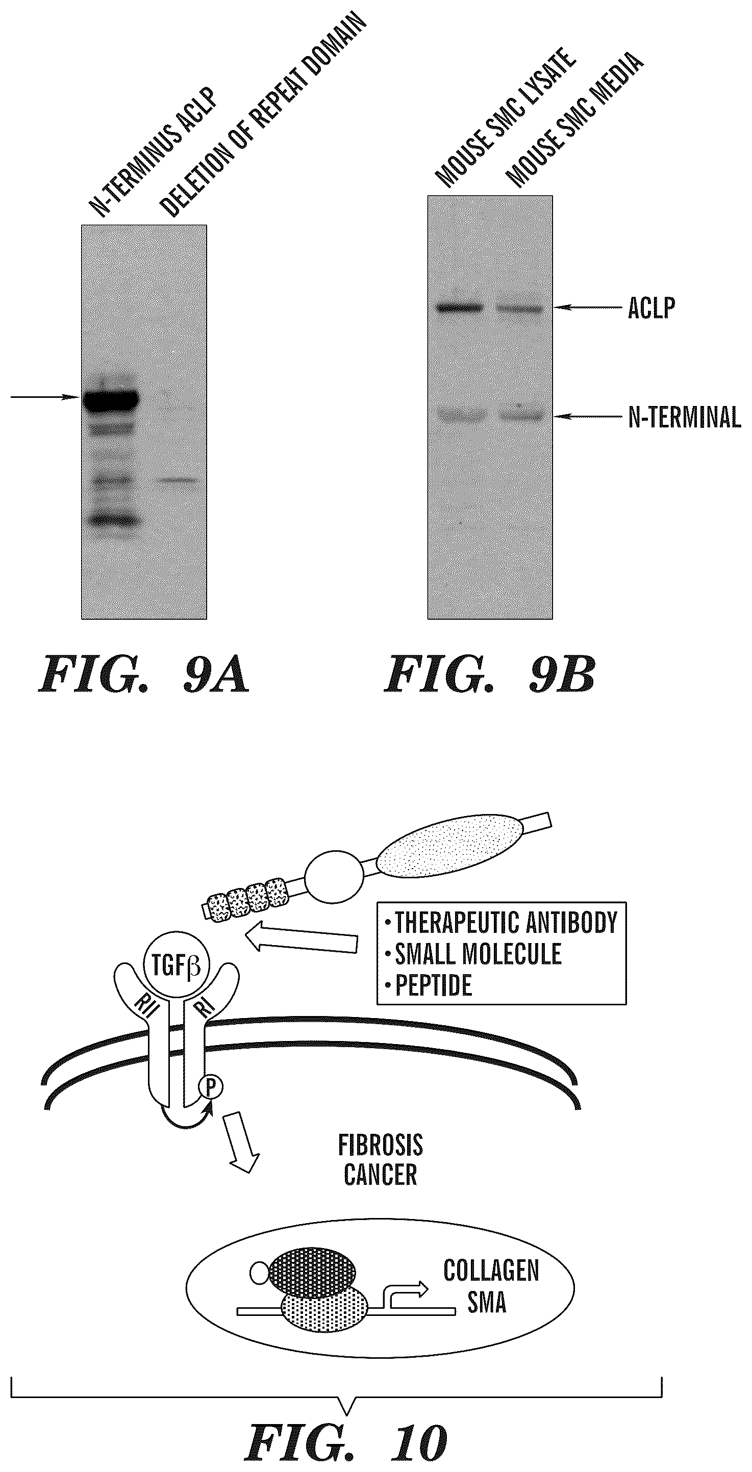 Patent US12139542 Figure 9 – Inhibitors of aortic carboxypeptidase-like protein (ACLP)
