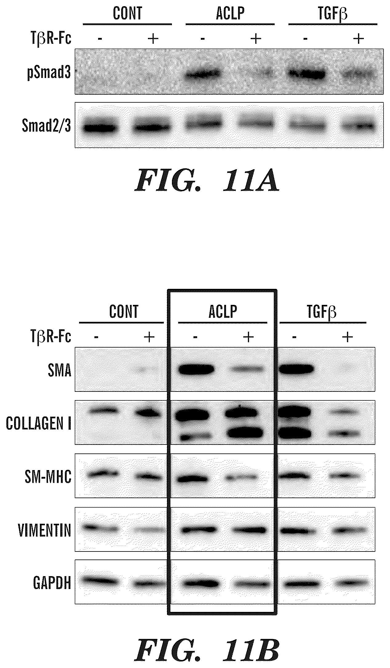 Patent US12139542 Figure 10 – Inhibitors of aortic carboxypeptidase-like protein (ACLP)