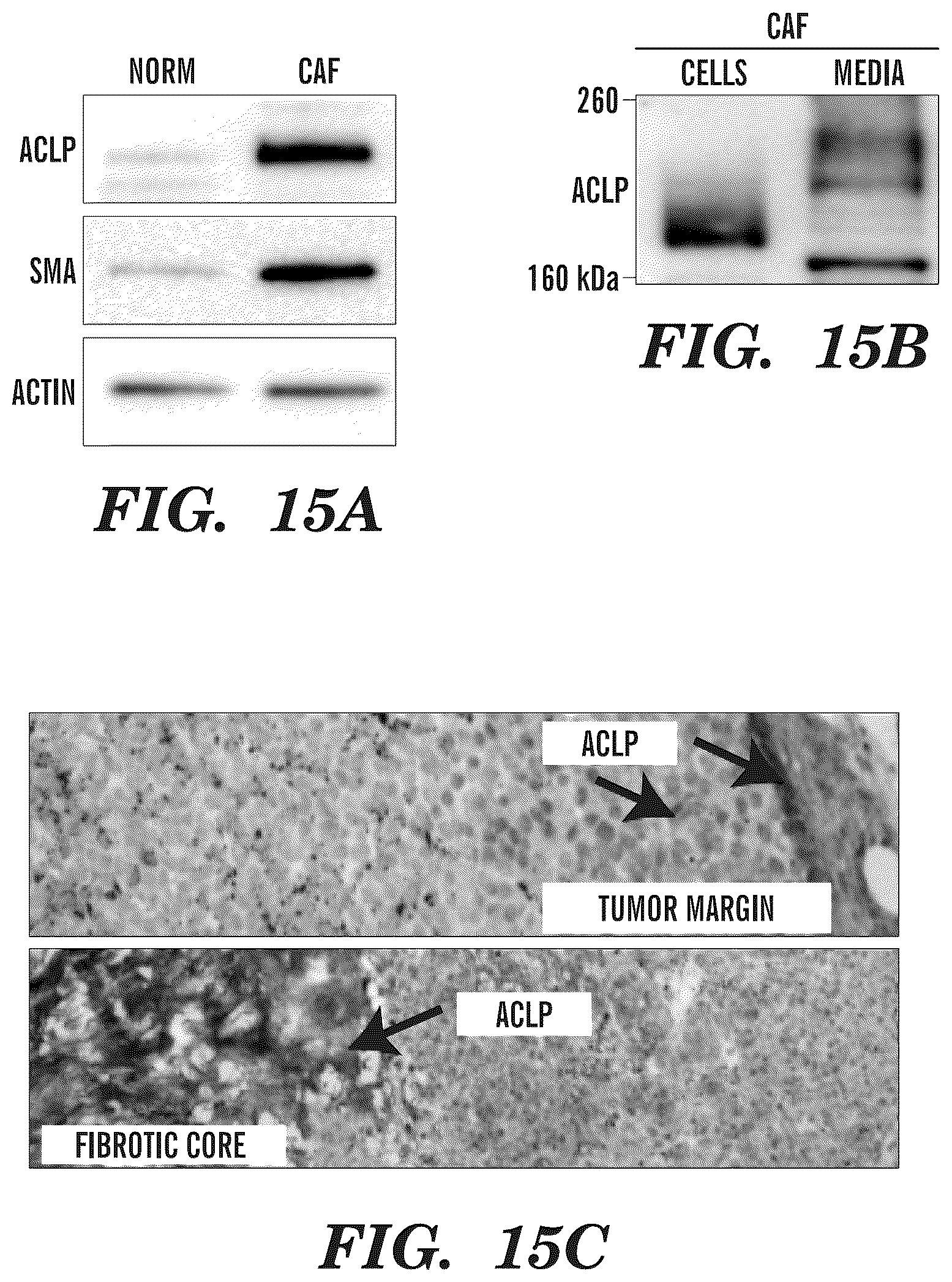 Patent US12139542 Figure 19 – Inhibitors of aortic carboxypeptidase-like protein (ACLP)