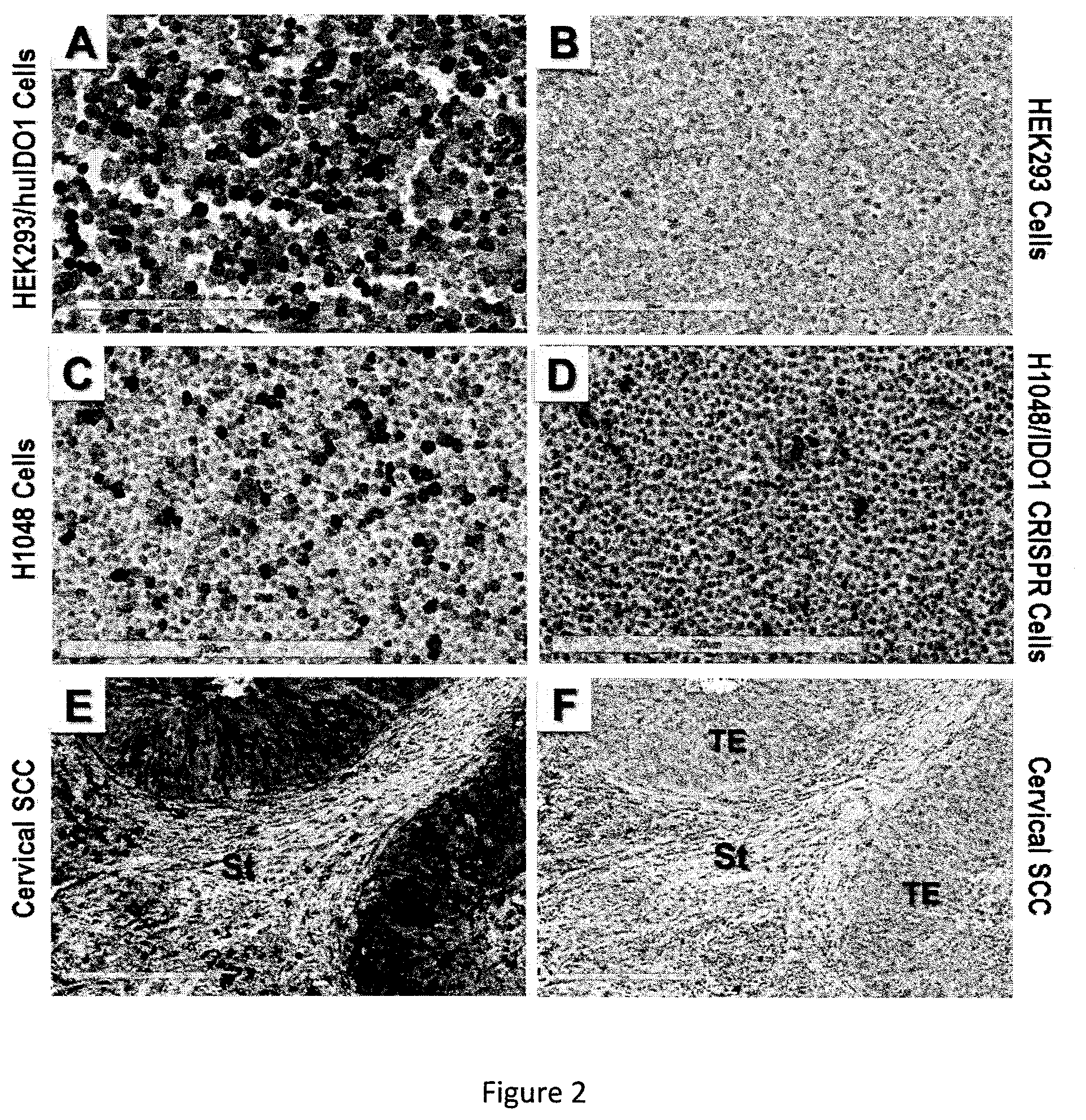 Patent US12139551 Figure 2 – Anti-IDO antibody and uses thereof