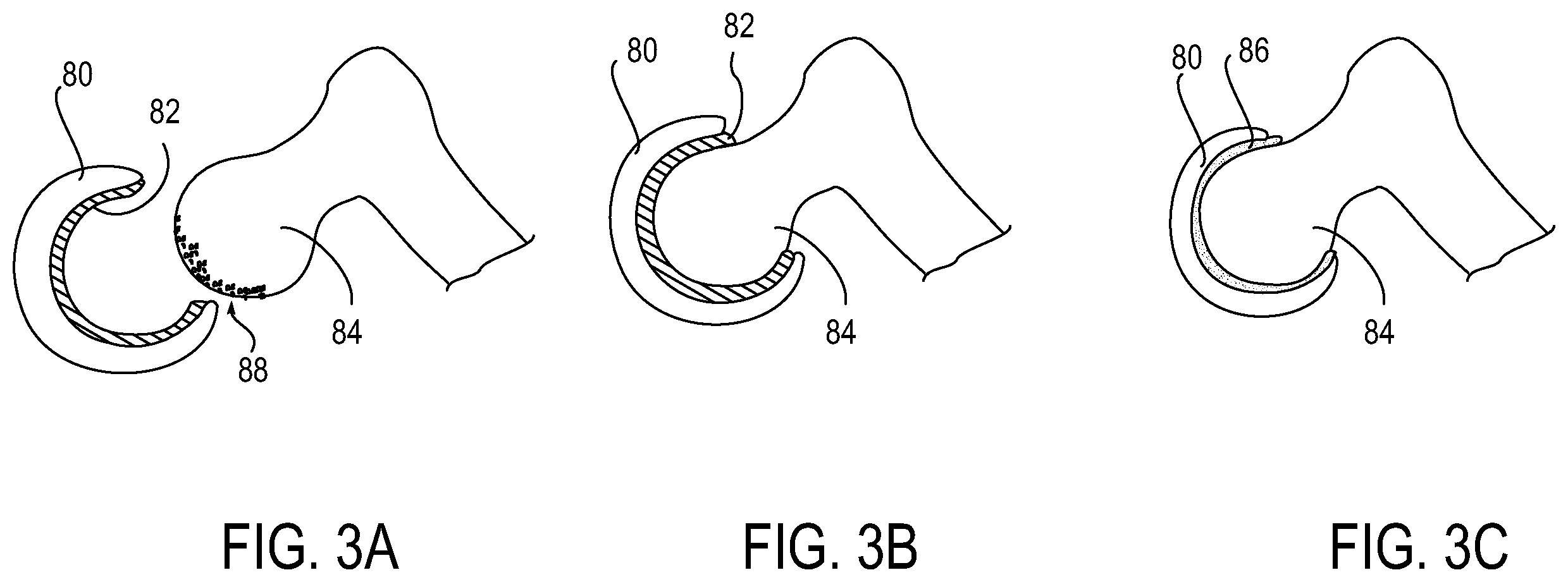 Patent US12139574 Figure 2 – Polymeric adhesive for anchoring compliant materials to another surface