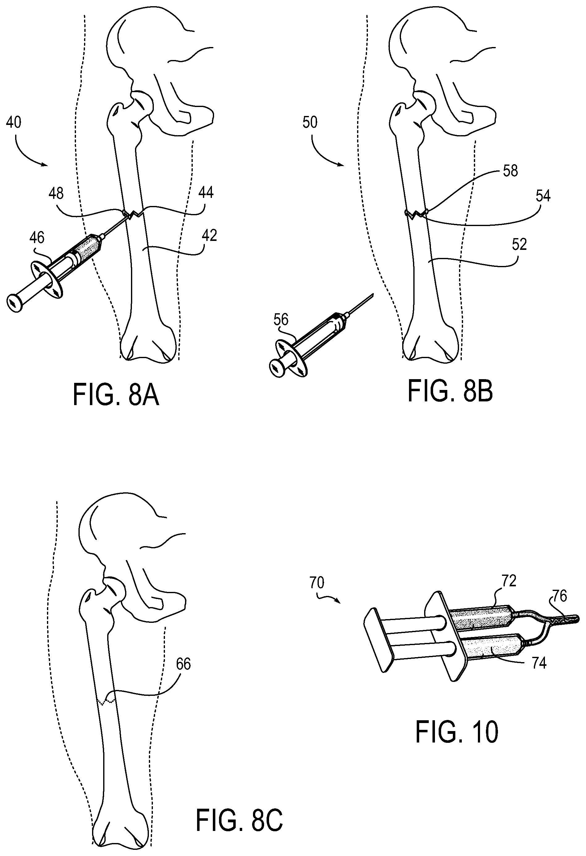 Patent US12139574 Figure 6 – Polymeric adhesive for anchoring compliant materials to another surface