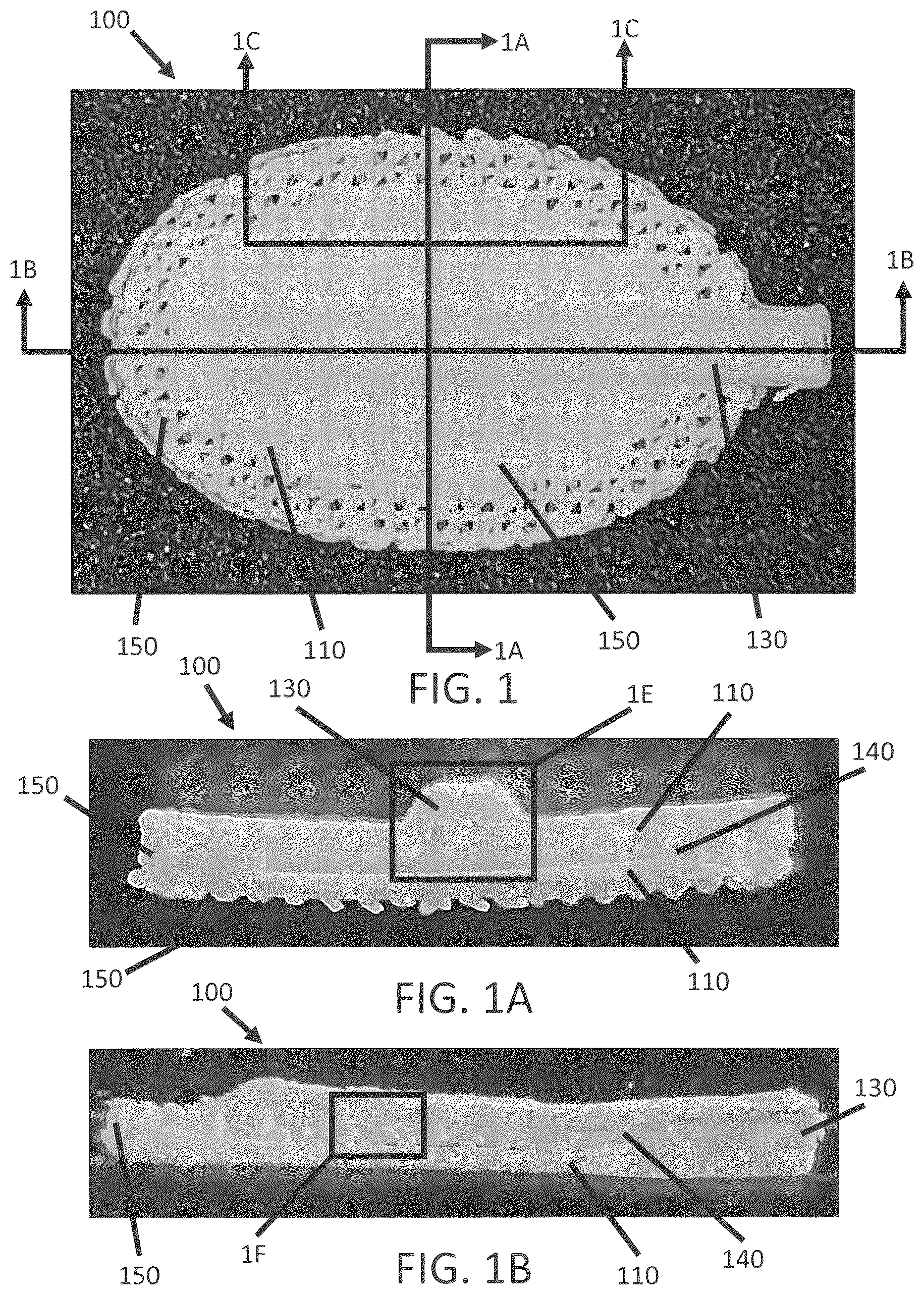 Patent US12139696 Figure 1 – Biointegrative implantable cell encapsulation device and system