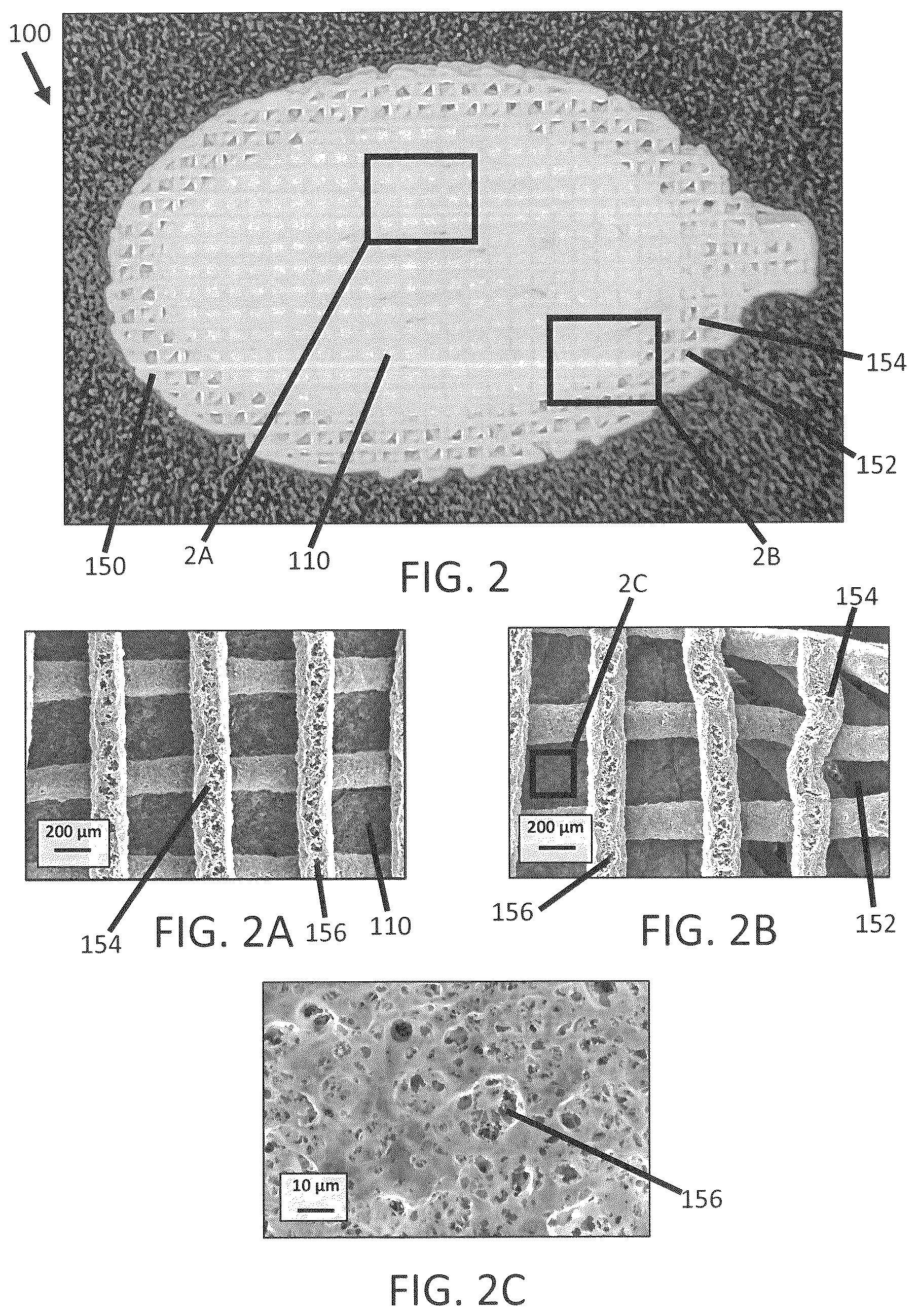 Patent US12139696 Figure 3 – Biointegrative implantable cell encapsulation device and system