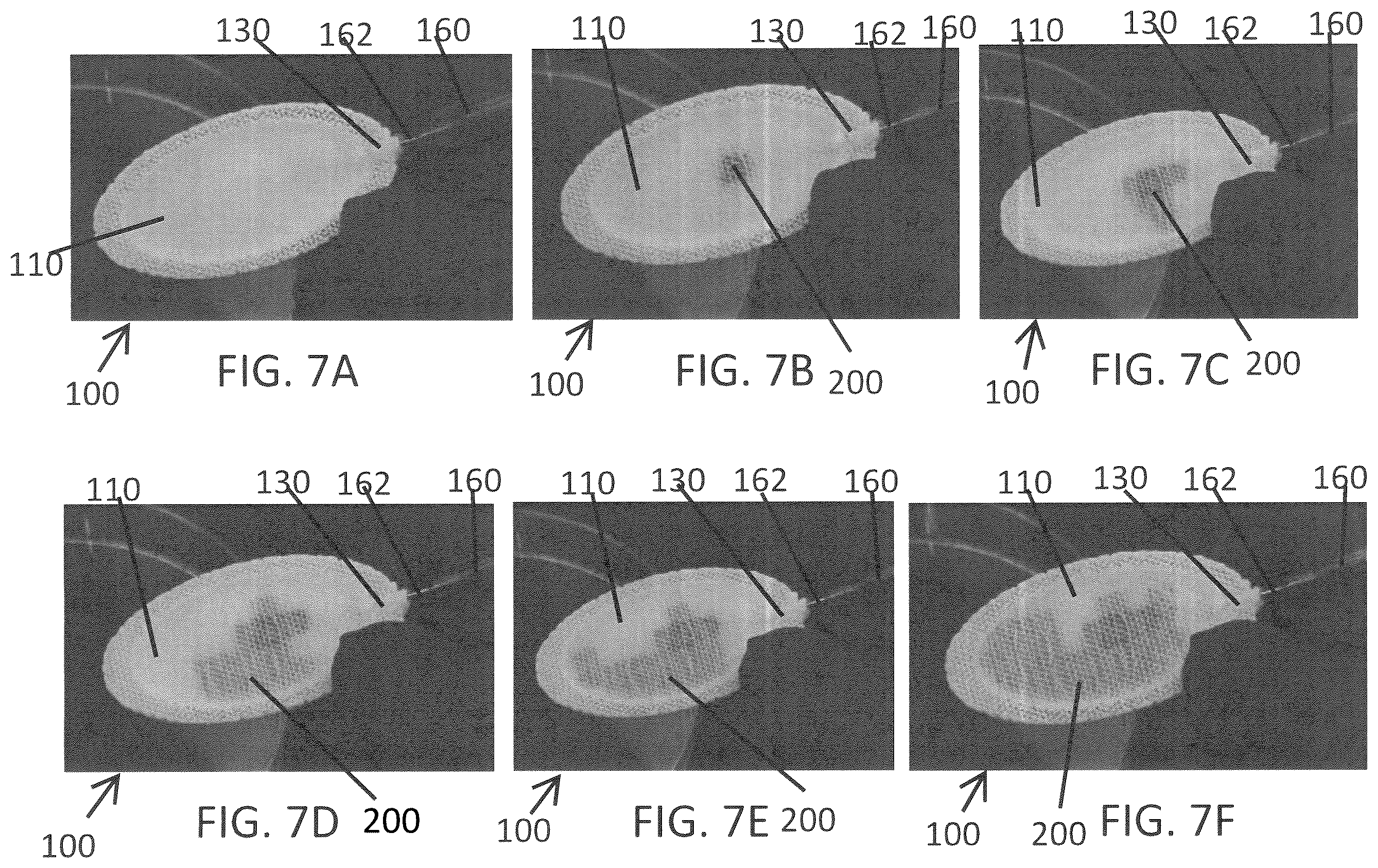 Patent US12139696 Figure 9 – Biointegrative implantable cell encapsulation device and system