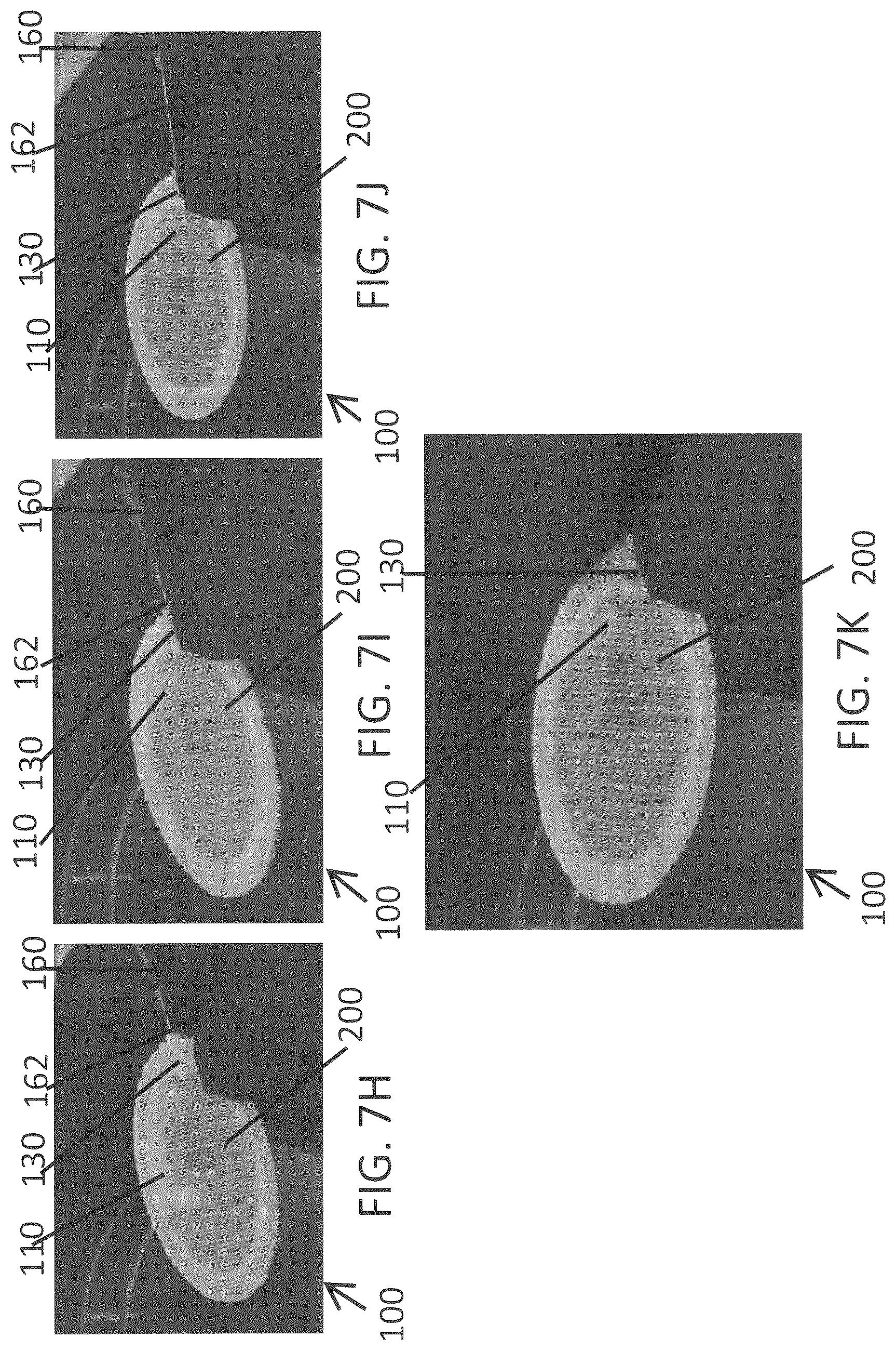 Patent US12139696 Figure 10 – Biointegrative implantable cell encapsulation device and system