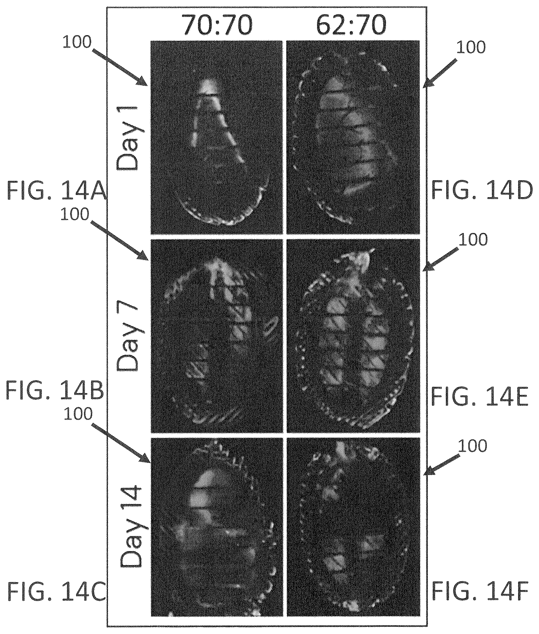 Patent US12139696 Figure 17 – Biointegrative implantable cell encapsulation device and system