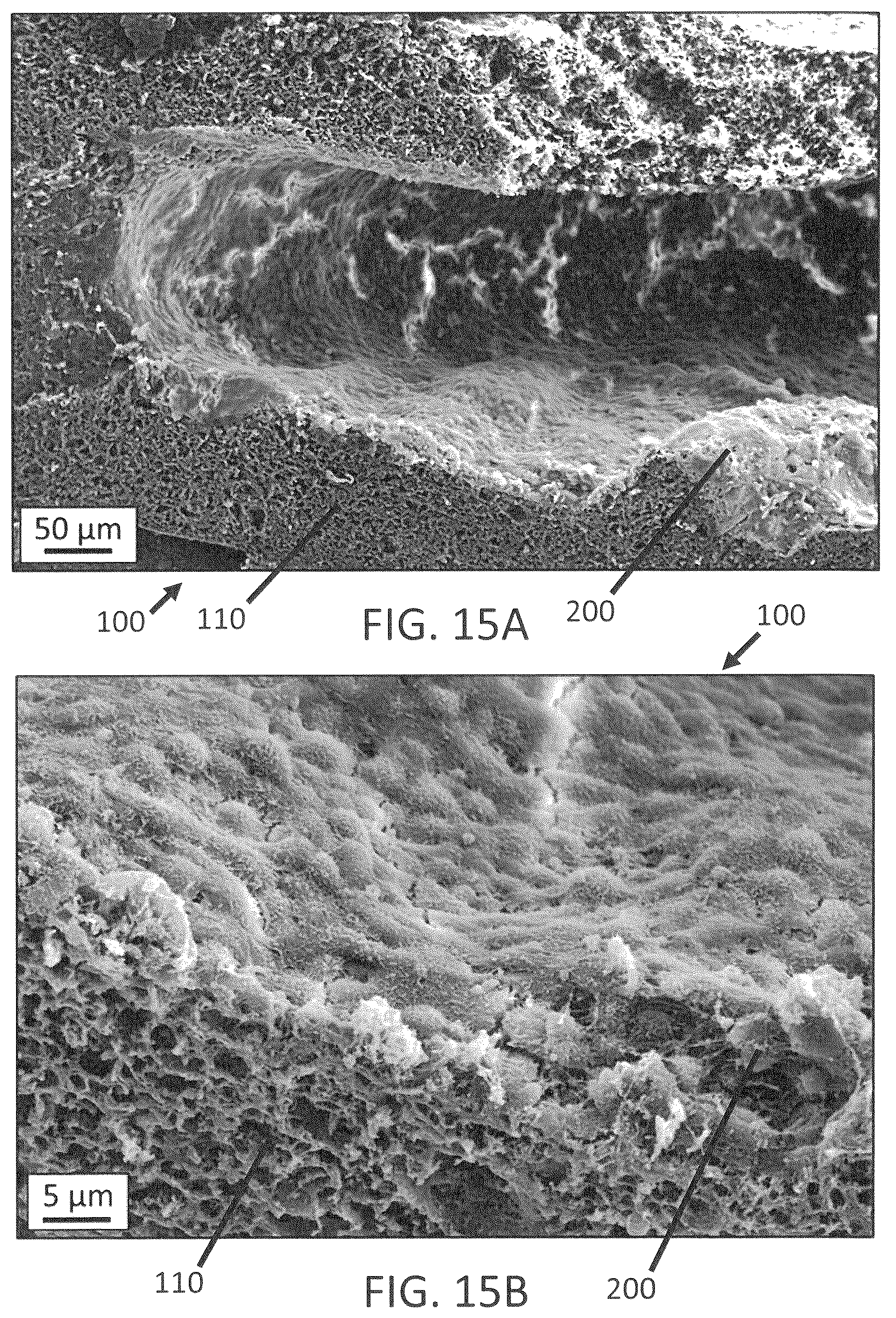 Patent US12139696 Figure 18 – Biointegrative implantable cell encapsulation device and system