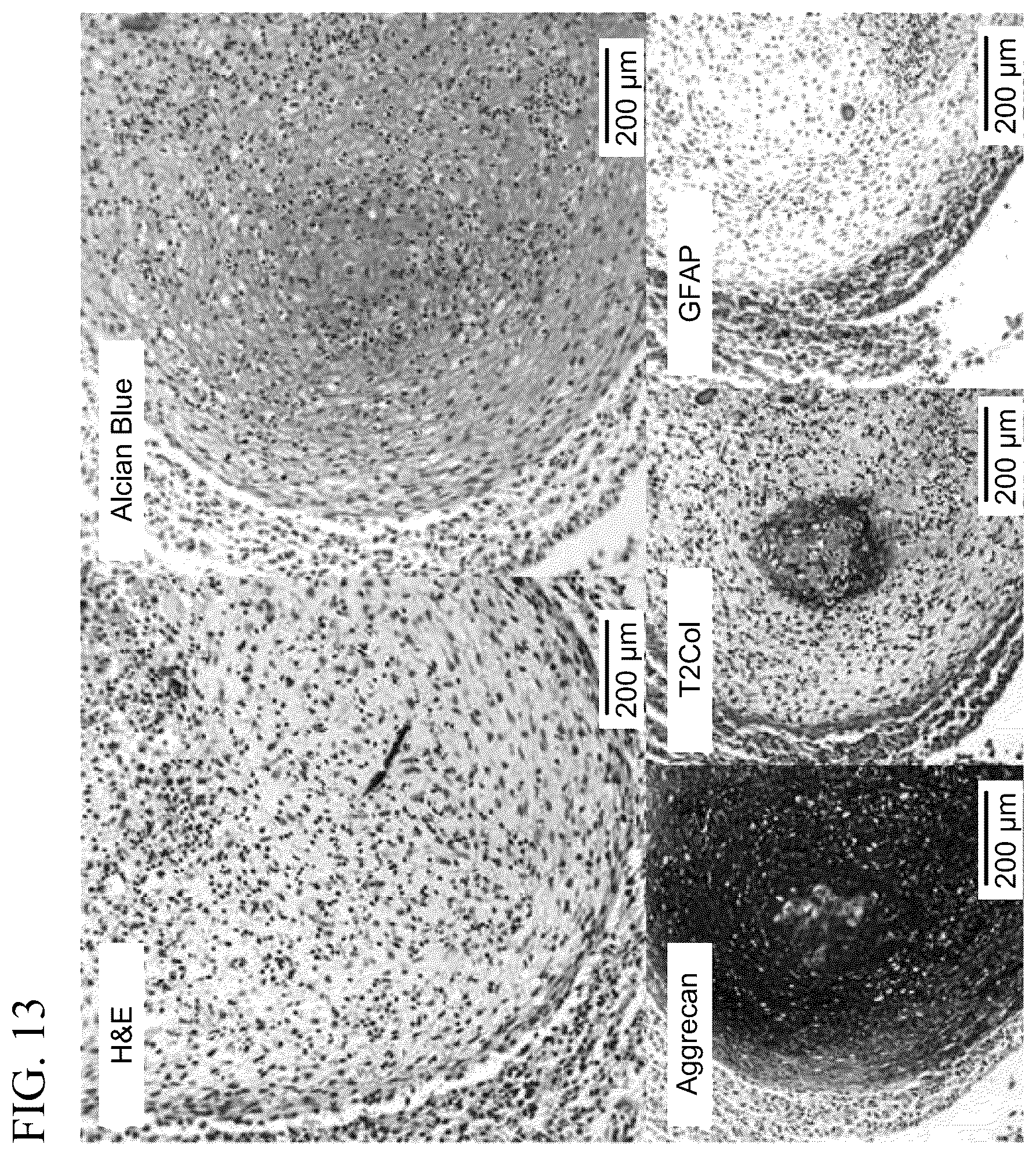 Patent US12139722 Figure 15 – Methods for generating and using organoids and tissue therein