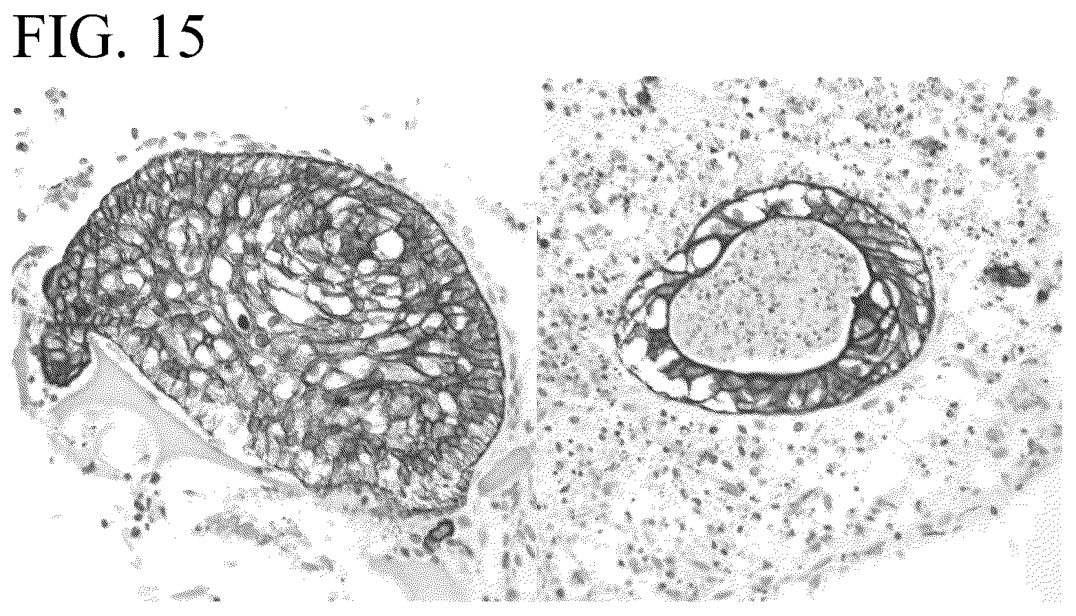 Patent US12139722 Figure 17 – Methods for generating and using organoids and tissue therein