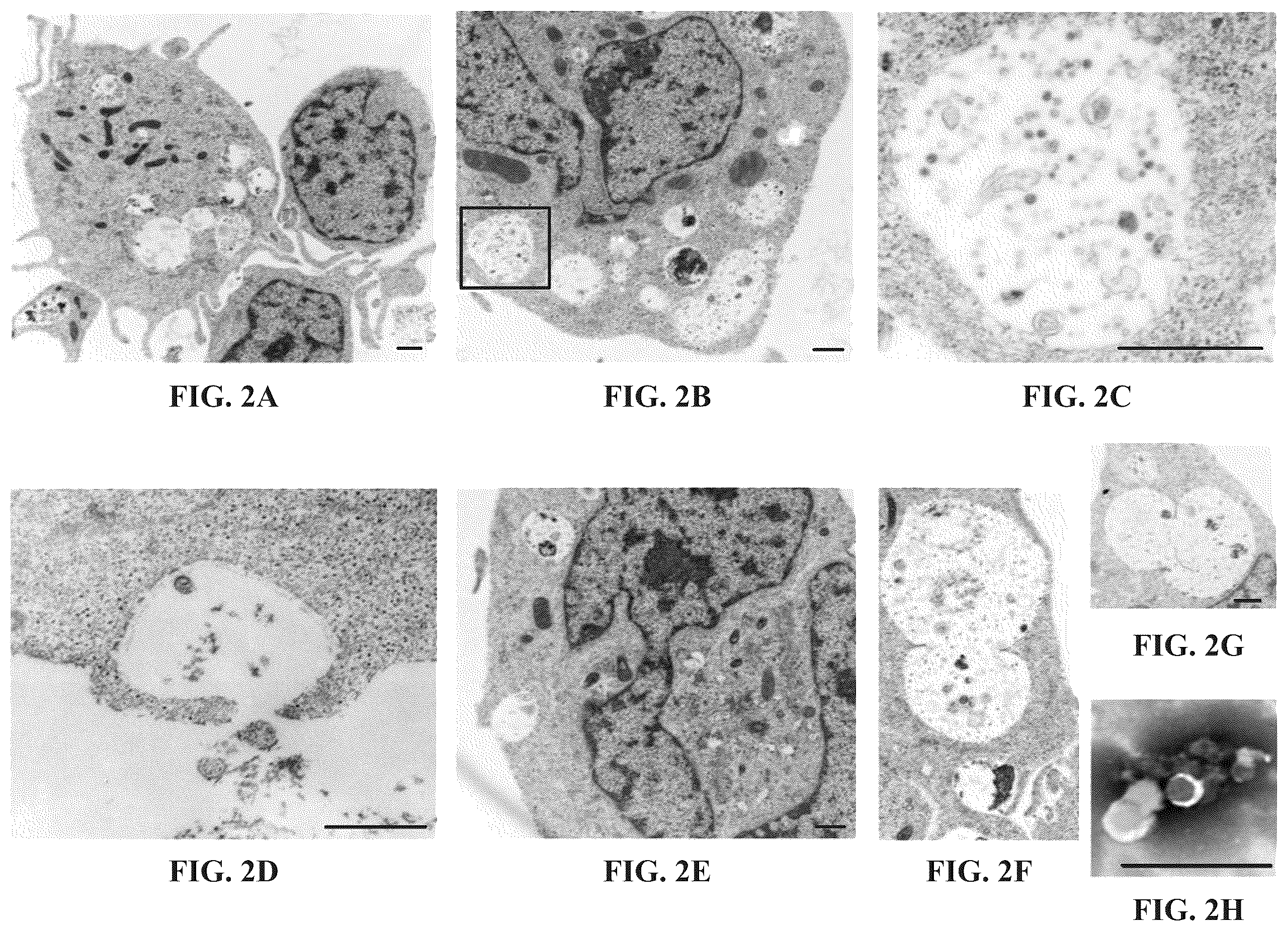 Patent US12139723 Figure 2 – Neural cell extracellular vesicles
