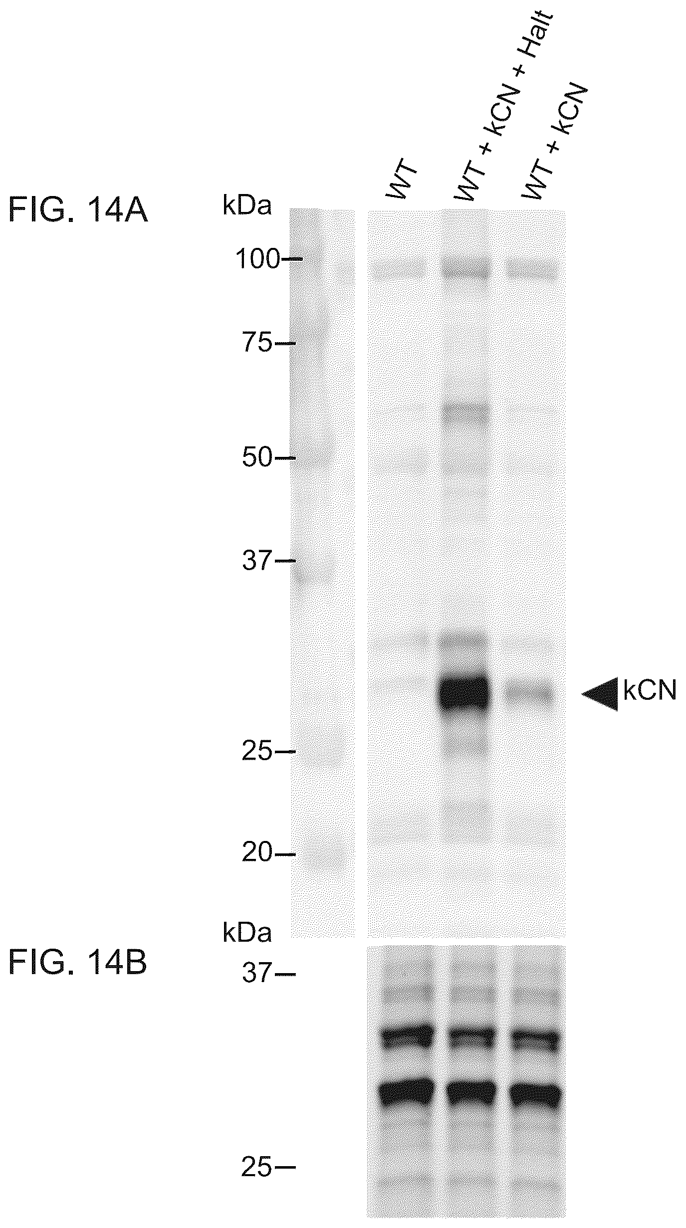 Patent US12139737 Figure 9 – Host cells comprising a recombinant casein protein and a recombinant kinase protein