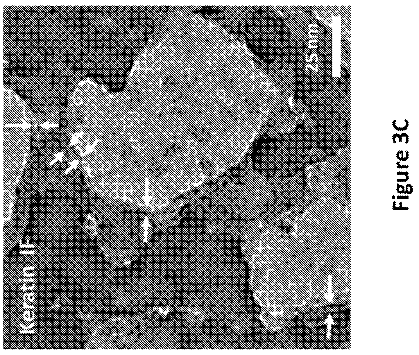 Patent US12139818 Figure 4 – Alpha-keratin solutions comprising alpha-keratin intermediate filaments in liquid crystal phase, methods of preparation, and uses thereof