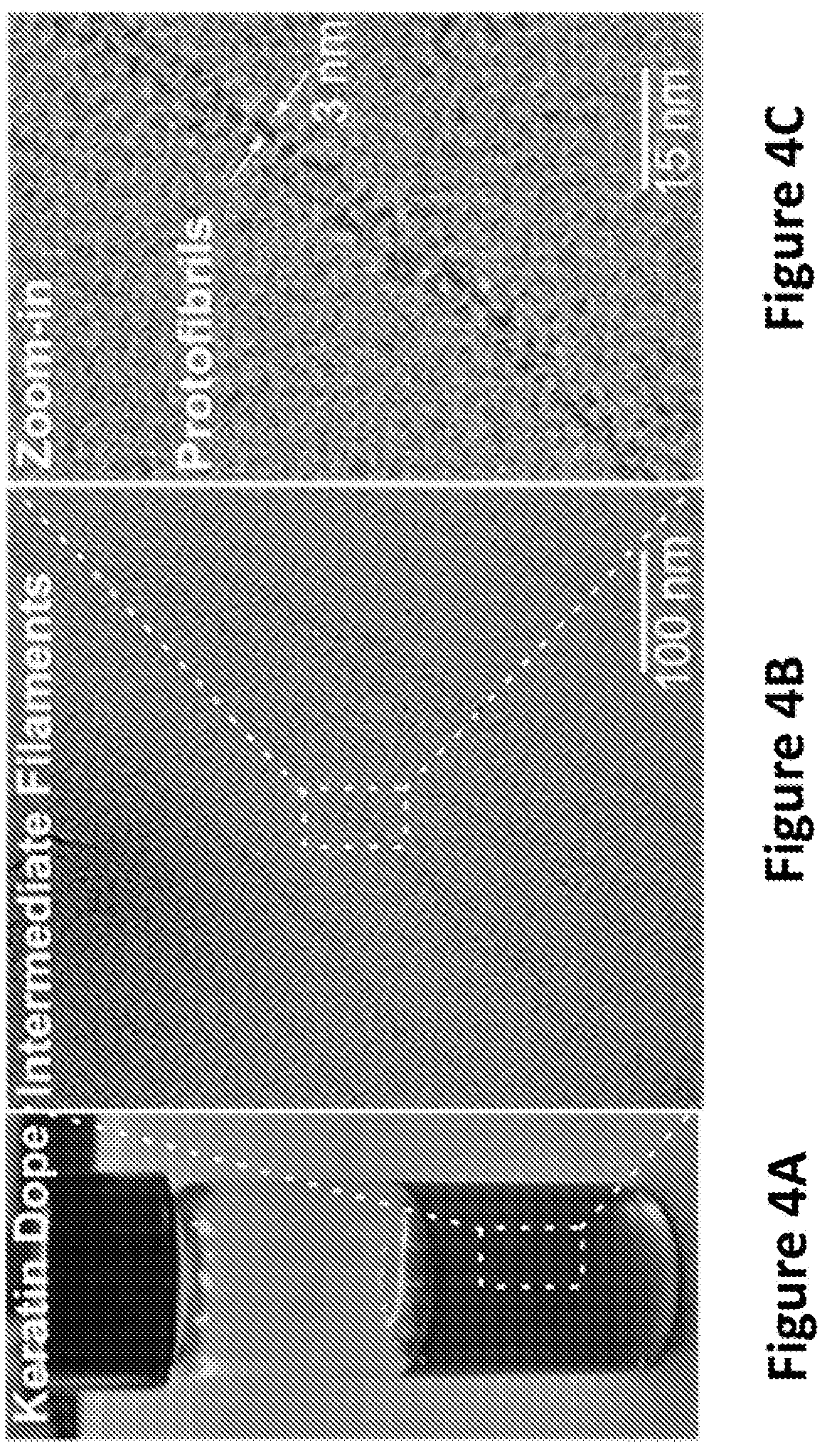 Patent US12139818 Figure 5 – Alpha-keratin solutions comprising alpha-keratin intermediate filaments in liquid crystal phase, methods of preparation, and uses thereof