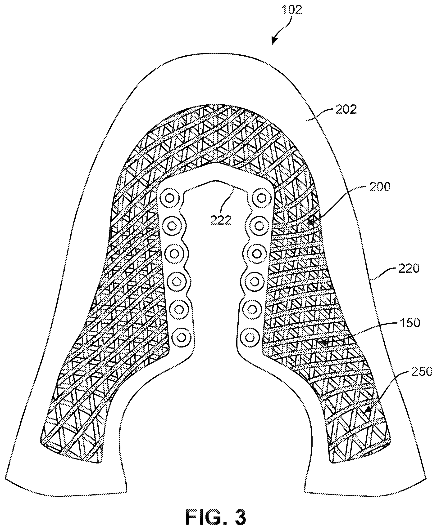 Patent US12139835 Figure 3 – Method of making article with ribbon structure and embroidered edges