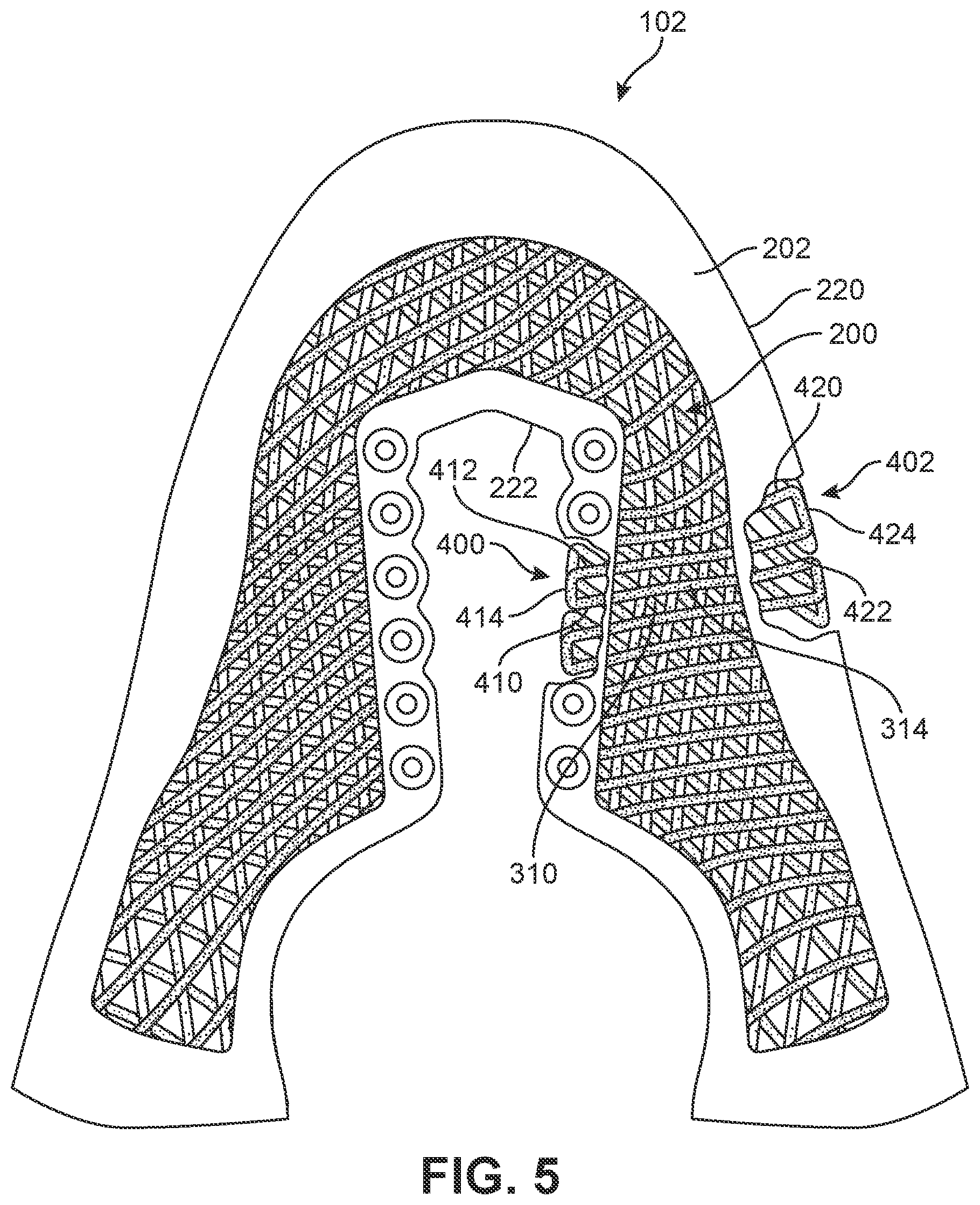 Patent US12139835 Figure 5 – Method of making article with ribbon structure and embroidered edges
