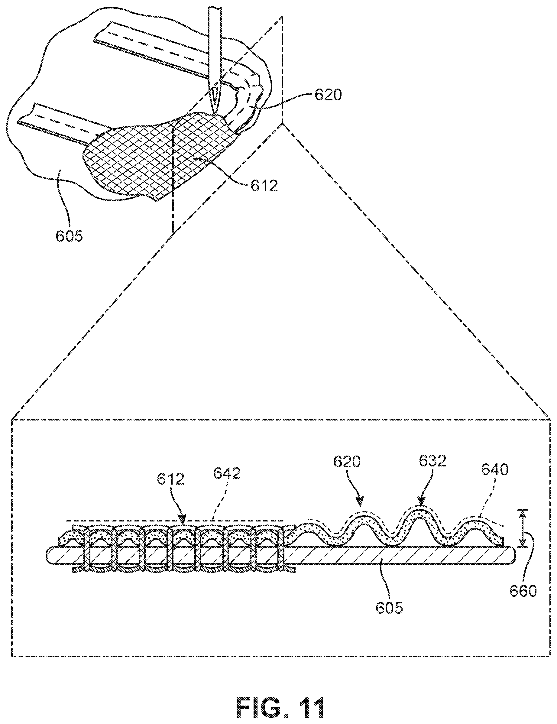 Patent US12139835 Figure 11 – Method of making article with ribbon structure and embroidered edges