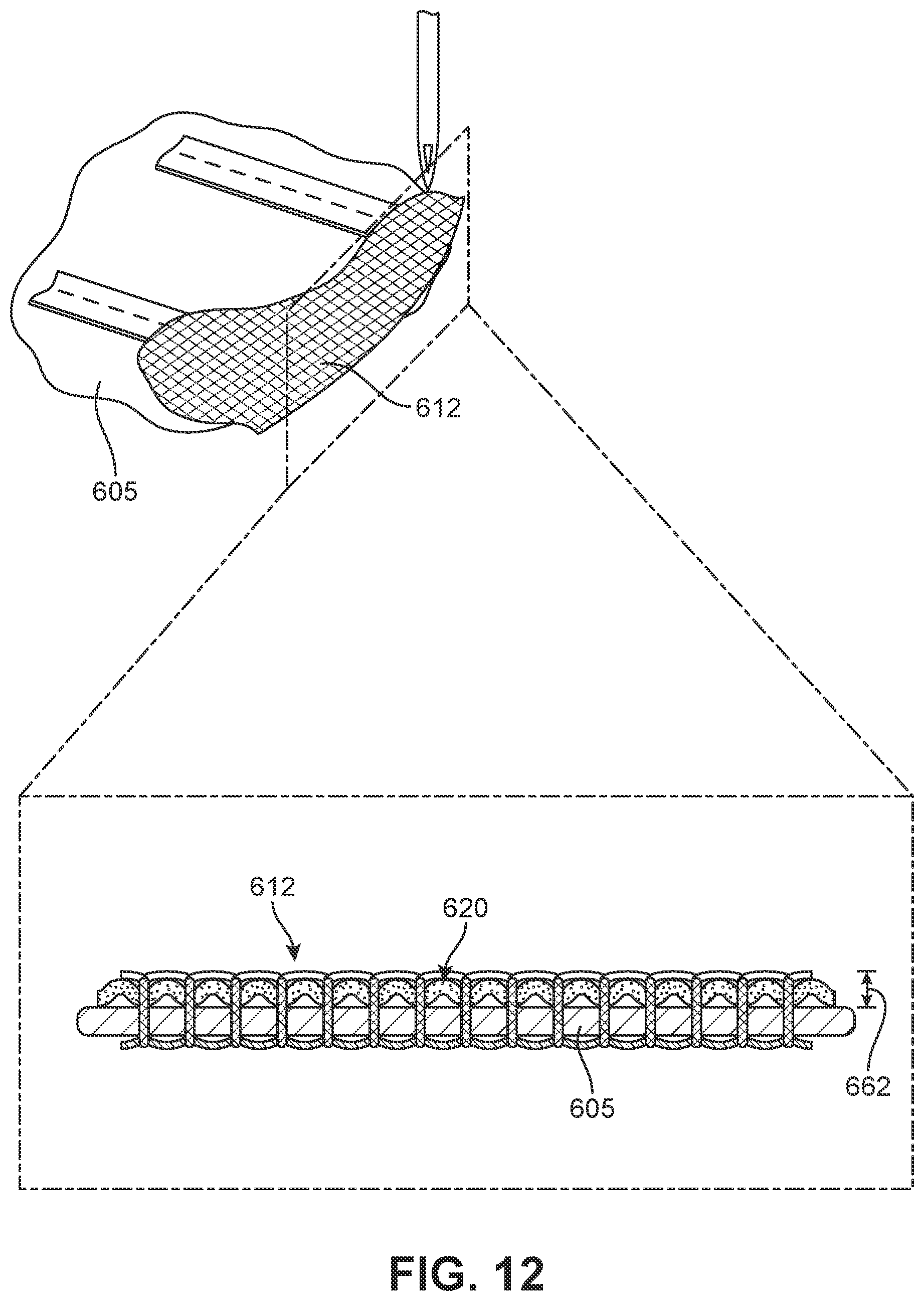 Patent US12139835 Figure 12 – Method of making article with ribbon structure and embroidered edges