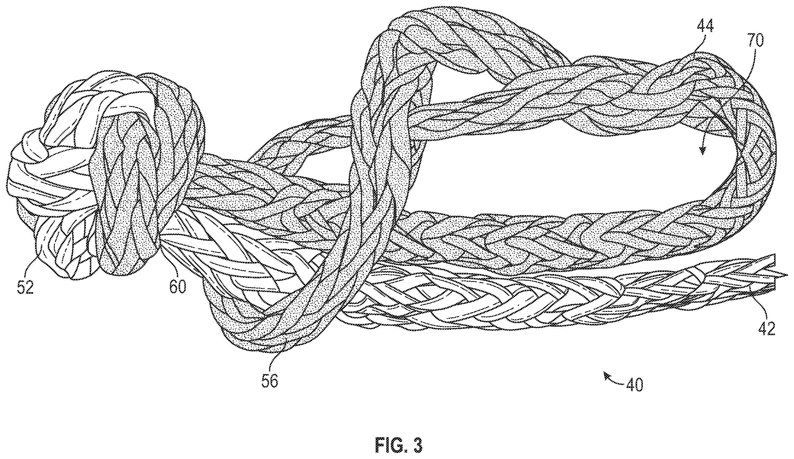 Patent US12139849 Figure 3 – Winch line for soft shackling