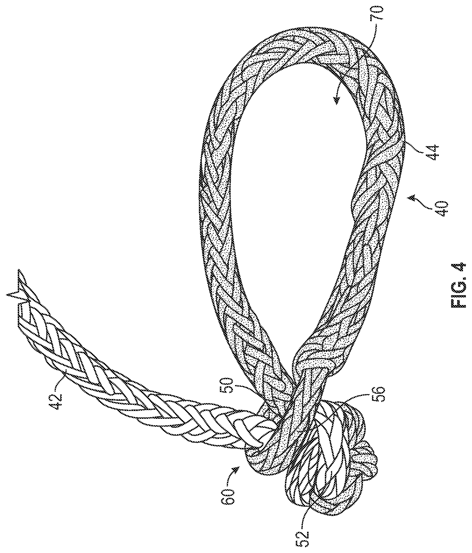 Patent US12139849 Figure 4 – Winch line for soft shackling