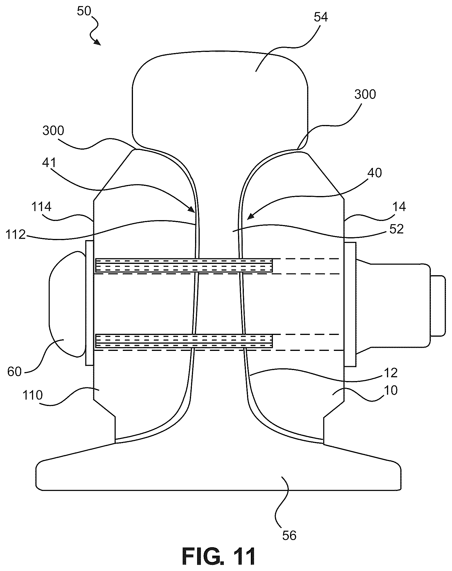 Patent US12139857 Figure 3 – Curved insulated rail joint bar and methods for making same