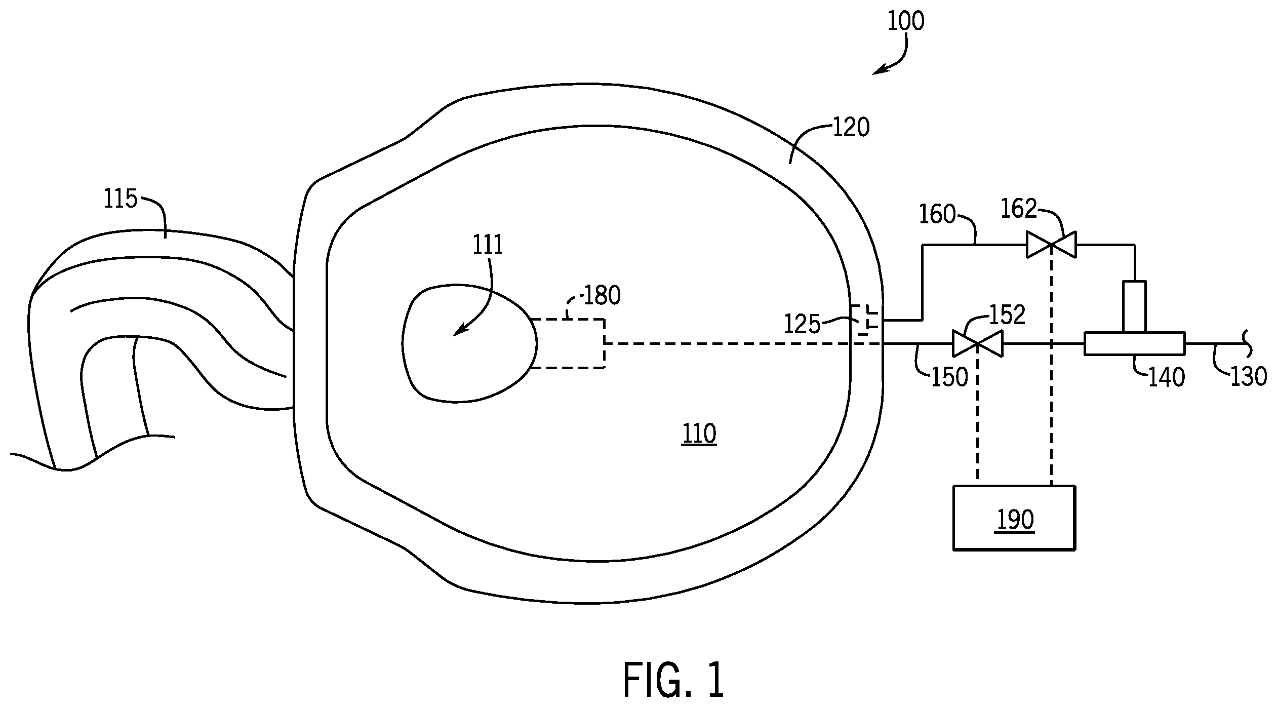 Patent US12139899 — Line pressure-driven, tankless, siphonic toilet — Figure 1