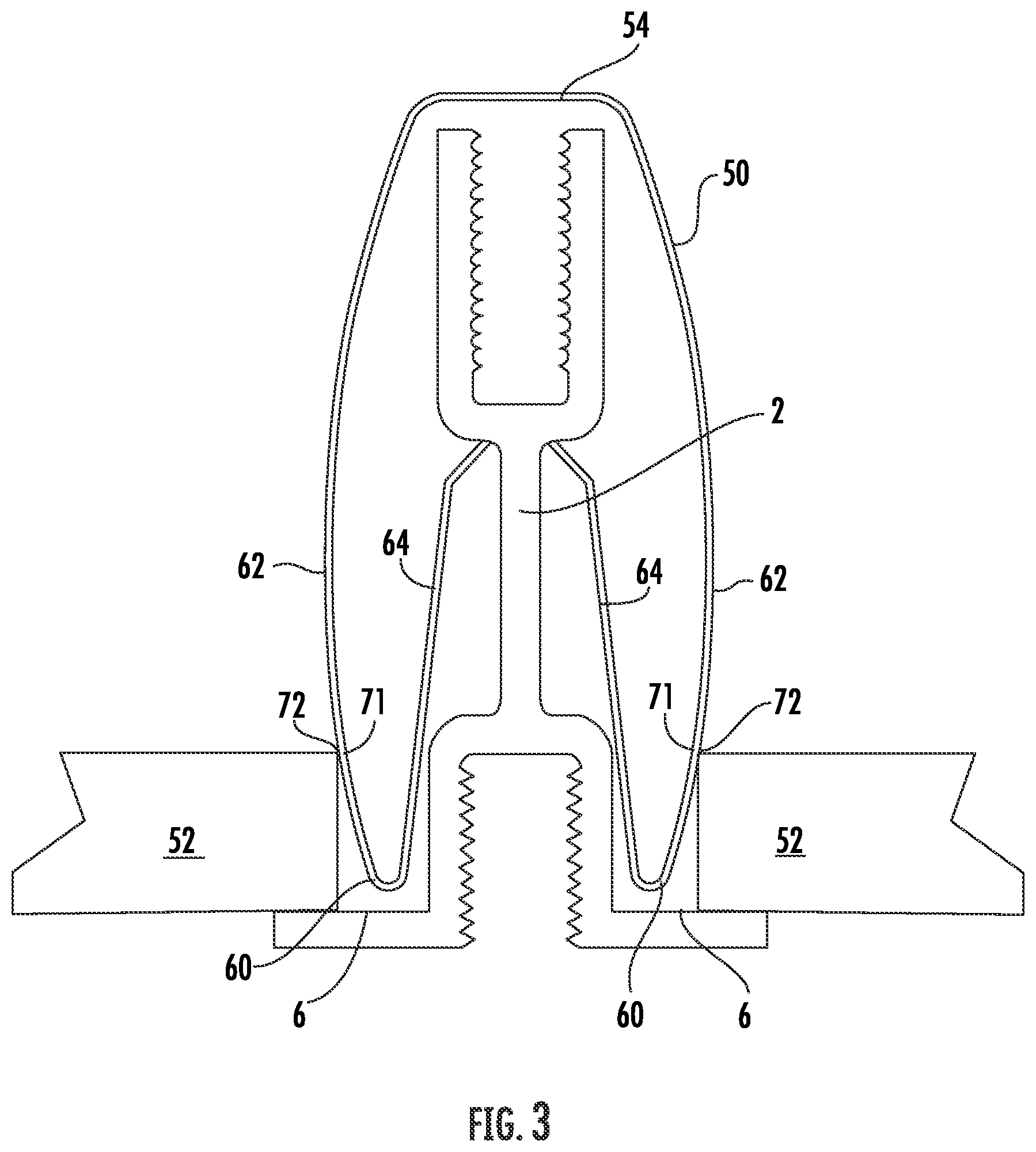 Patent US12139908 Figure 4 – Suspended ceiling panel holding clip