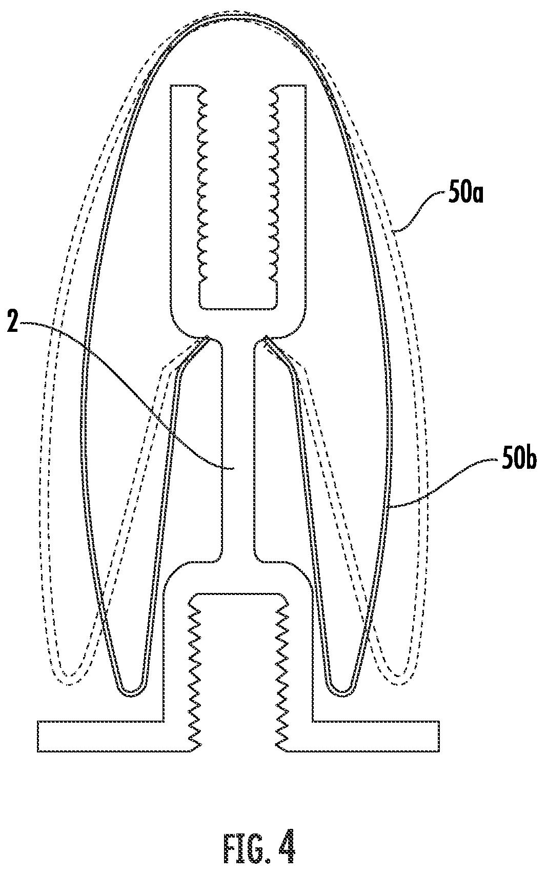 Patent US12139908 Figure 5 – Suspended ceiling panel holding clip
