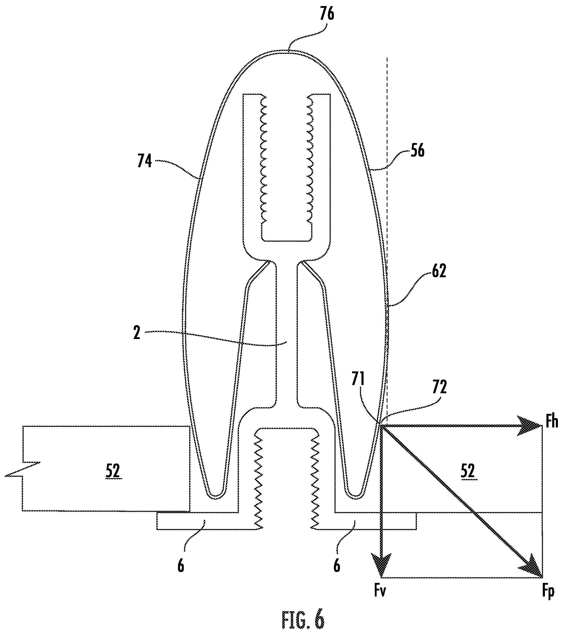 Patent US12139908 Figure 7 – Suspended ceiling panel holding clip