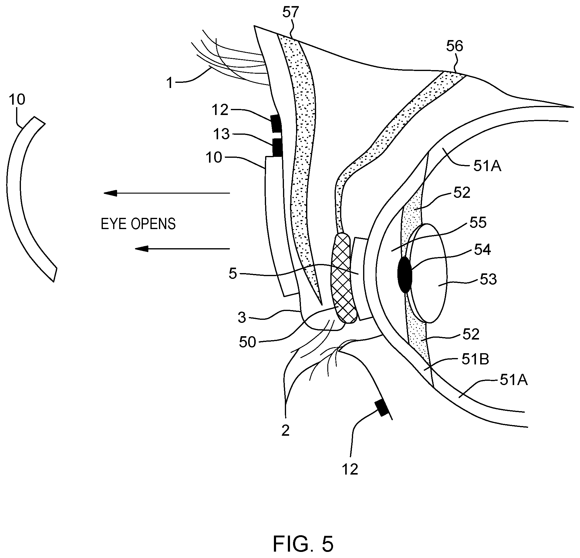 Patent US12147091 Figure 2 – Piezoelectric device powering smart contact lens with eyelid movement