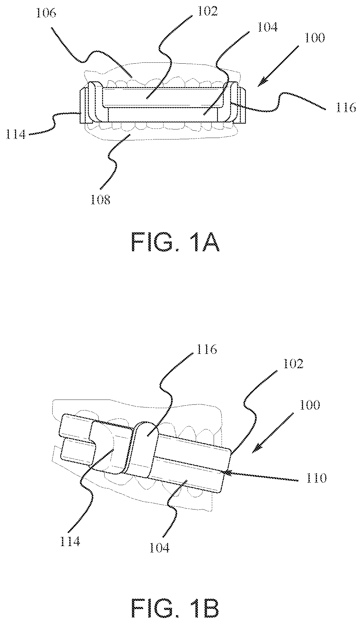 Patent US12147214 Figure 1 – Computer aided design matrix for the manufacture of dental devices